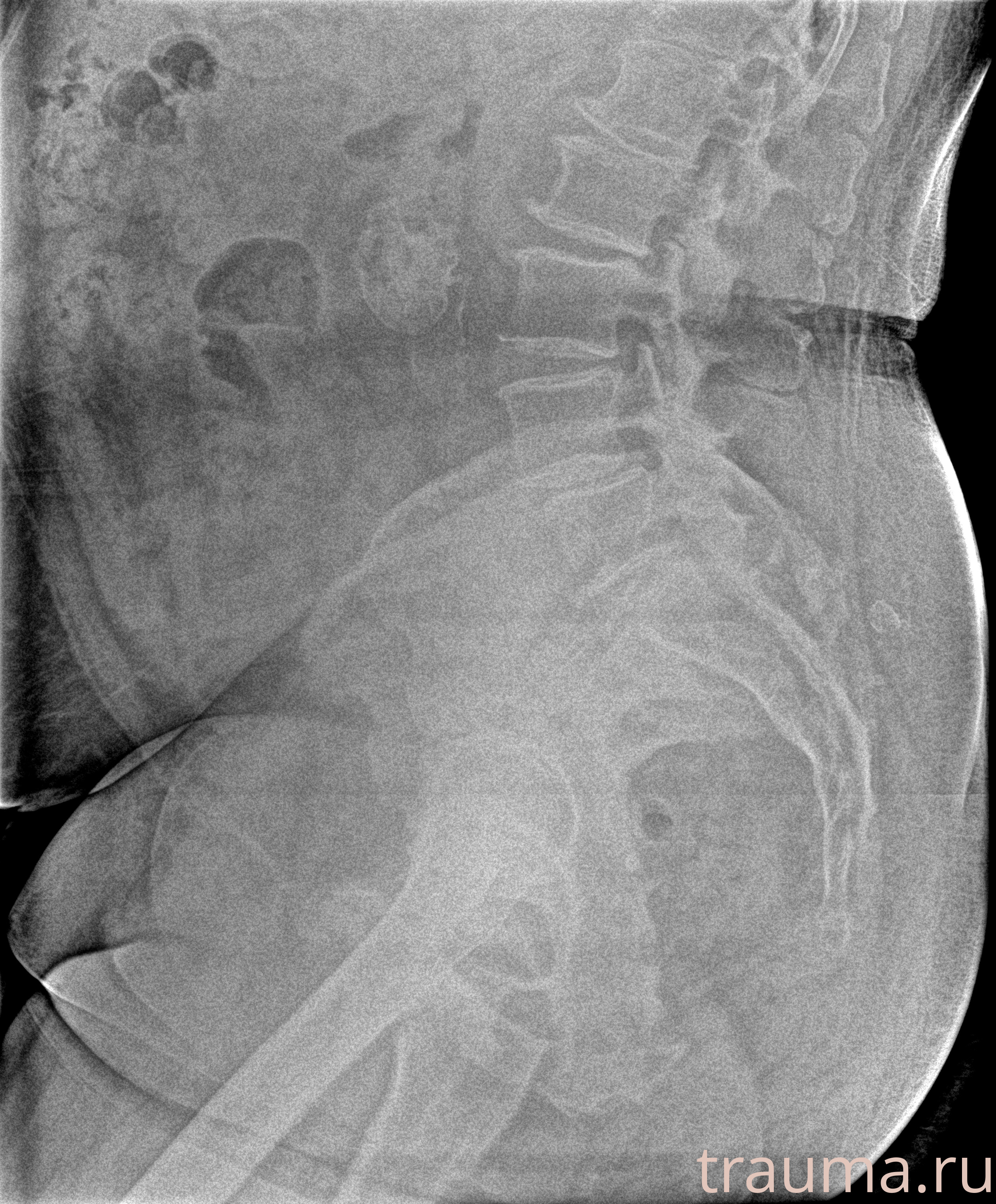 Рентген на дому: по вашему адресу приезжает врач-рентгенолог, травматолог-ортопед с мобильным рентгеновским аппаратом, проводит диагностику травмы или заболевания, делает необходимые рентгенограммы, дает рекомендации по дальнейшему лечению. Получить качественные снимки в домашних условиях возможно благодаря уникальной методике, разработанной МосРентген Центром для института  Склифосовского
