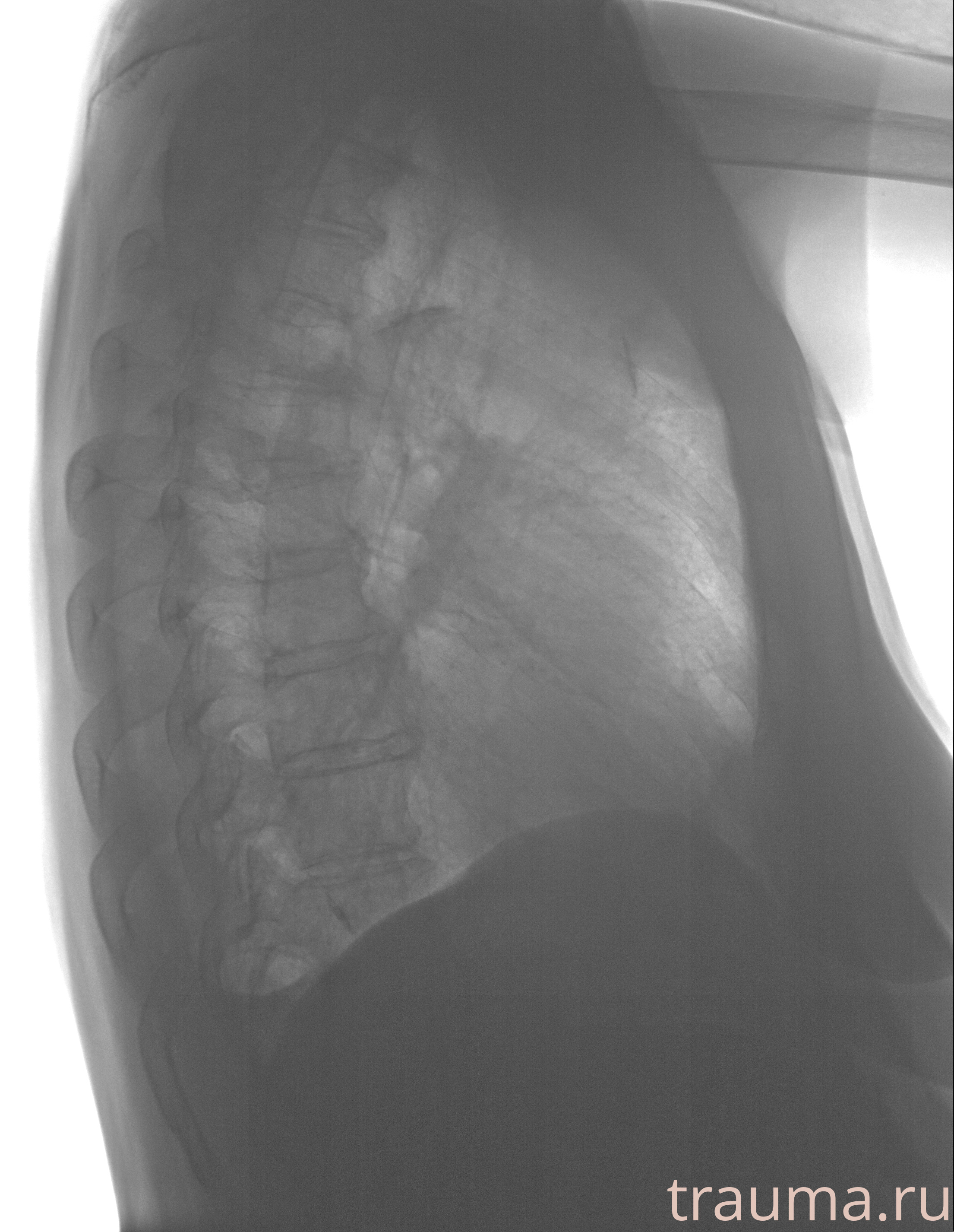 Рентген на дому: по вашему адресу приезжает врач-рентгенолог, травматолог-ортопед с мобильным рентгеновским аппаратом, проводит диагностику травмы или заболевания, делает необходимые рентгенограммы, дает рекомендации по дальнейшему лечению. Получить качественные снимки в домашних условиях возможно благодаря уникальной методике, разработанной МосРентген Центром для института  Склифосовского