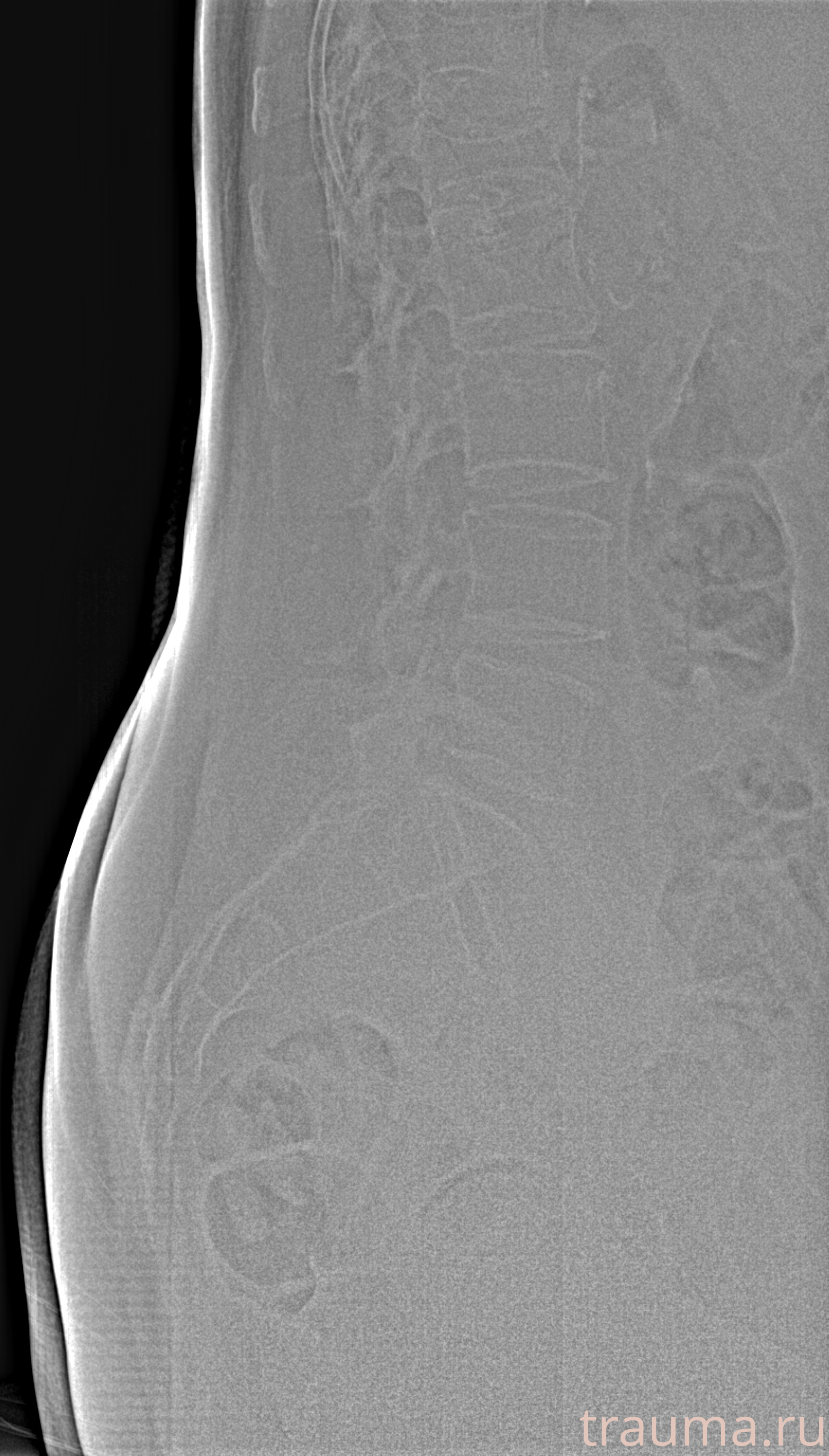 Рентген на дому: по вашему адресу приезжает врач-рентгенолог, травматолог-ортопед с мобильным рентгеновским аппаратом, проводит диагностику травмы или заболевания, делает необходимые рентгенограммы, дает рекомендации по дальнейшему лечению. Получить качественные снимки в домашних условиях возможно благодаря уникальной методике, разработанной МосРентген Центром для института  Склифосовского