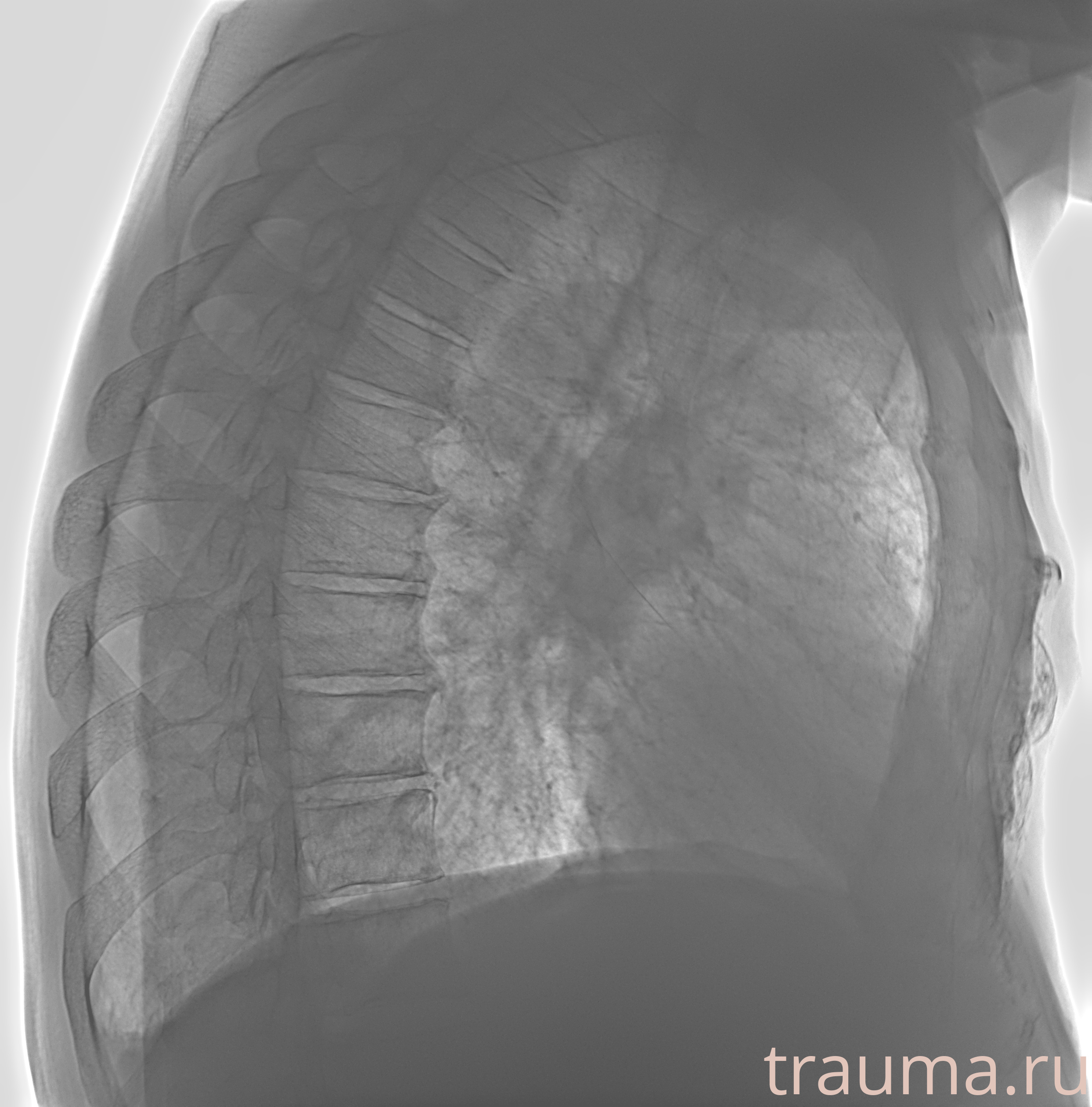 Рентген на дому: по вашему адресу приезжает врач-рентгенолог, травматолог-ортопед с мобильным рентгеновским аппаратом, проводит диагностику травмы или заболевания, делает необходимые рентгенограммы, дает рекомендации по дальнейшему лечению. Получить качественные снимки в домашних условиях возможно благодаря уникальной методике, разработанной МосРентген Центром для института  Склифосовского