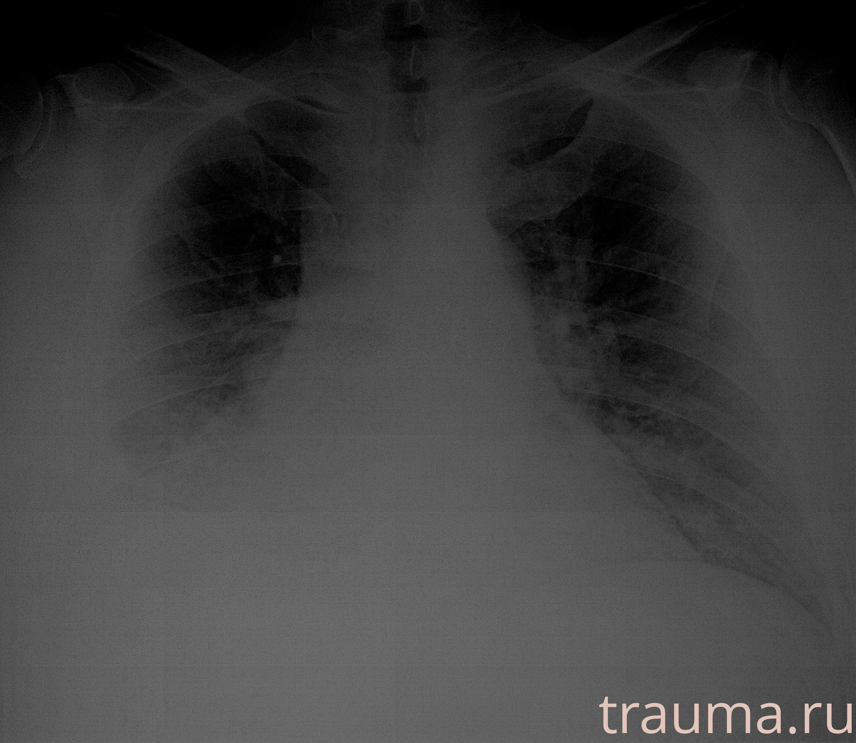 Рентген на дому: по вашему адресу приезжает врач-рентгенолог, травматолог-ортопед с мобильным рентгеновским аппаратом, проводит диагностику травмы или заболевания, делает необходимые рентгенограммы, дает рекомендации по дальнейшему лечению. Получить качественные снимки в домашних условиях возможно благодаря уникальной методике, разработанной МосРентген Центром для института  Склифосовского