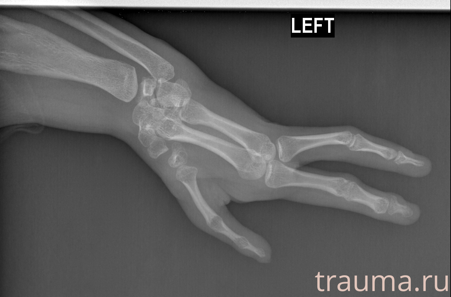 Рентген на дому: по вашему адресу приезжает врач-рентгенолог, травматолог-ортопед с мобильным рентгеновским аппаратом, проводит диагностику травмы или заболевания, делает необходимые рентгенограммы, дает рекомендации по дальнейшему лечению. Получить качественные снимки в домашних условиях возможно благодаря уникальной методике, разработанной МосРентген Центром для института  Склифосовского