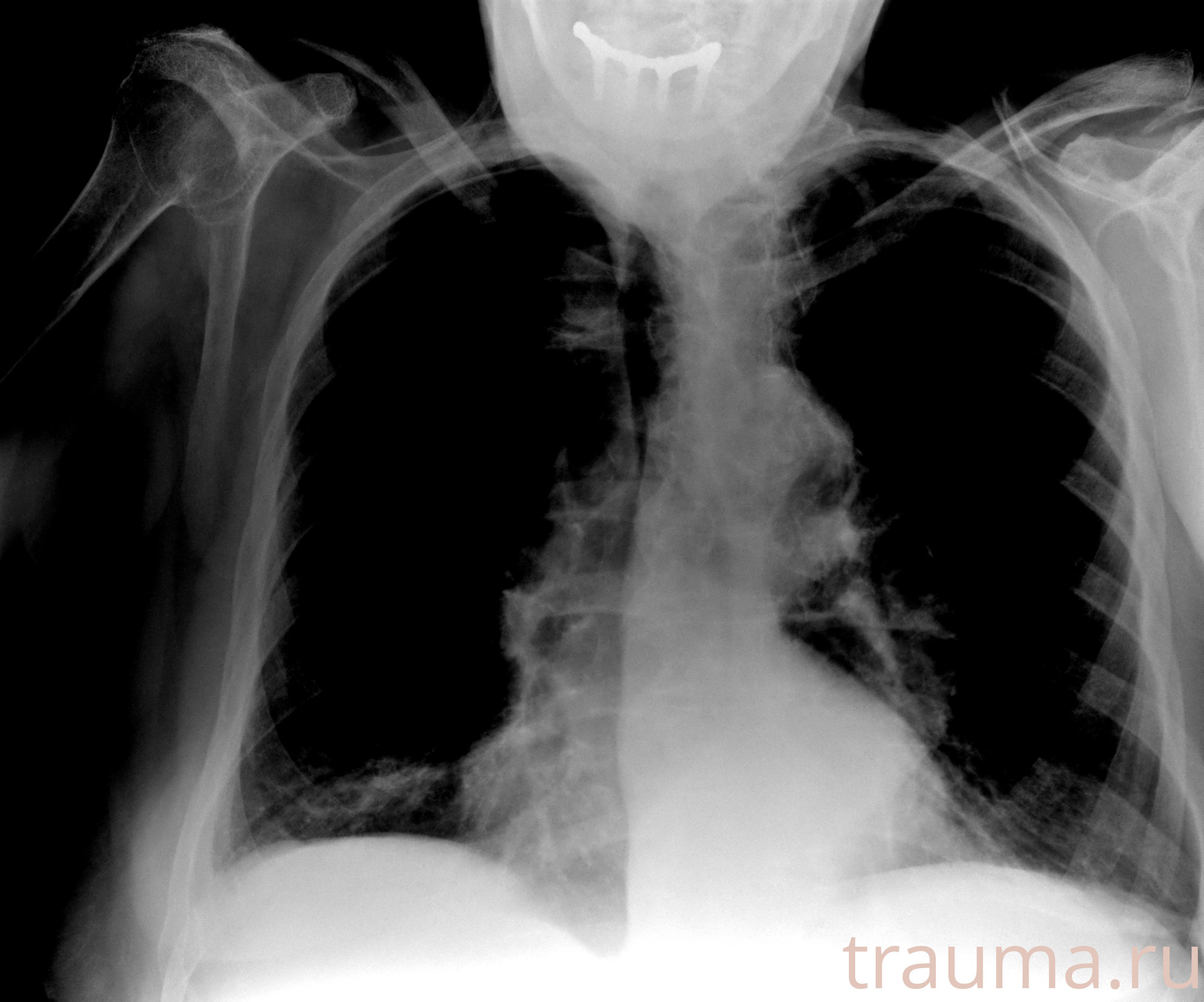 Рентген на дому: по вашему адресу приезжает врач-рентгенолог, травматолог-ортопед с мобильным рентгеновским аппаратом, проводит диагностику травмы или заболевания, делает необходимые рентгенограммы, дает рекомендации по дальнейшему лечению. Получить качественные снимки в домашних условиях возможно благодаря уникальной методике, разработанной МосРентген Центром для института  Склифосовского