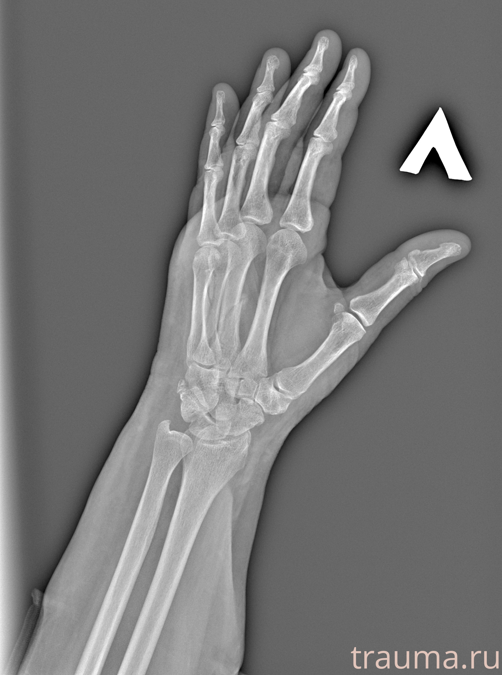 Рентген на дому: по вашему адресу приезжает врач-рентгенолог, травматолог-ортопед с мобильным рентгеновским аппаратом, проводит диагностику травмы или заболевания, делает необходимые рентгенограммы, дает рекомендации по дальнейшему лечению. Получить качественные снимки в домашних условиях возможно благодаря уникальной методике, разработанной МосРентген Центром для института  Склифосовского