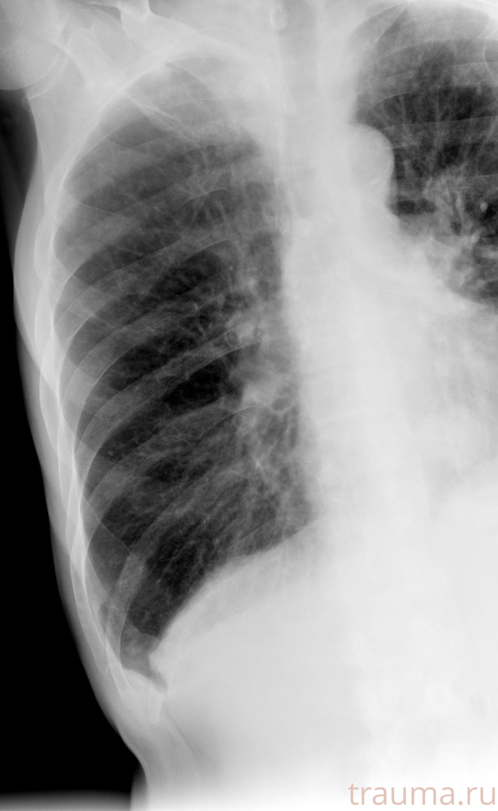 Рентген на дому: по вашему адресу приезжает врач-рентгенолог, травматолог-ортопед с мобильным рентгеновским аппаратом, проводит диагностику травмы или заболевания, делает необходимые рентгенограммы, дает рекомендации по дальнейшему лечению. Получить качественные снимки в домашних условиях возможно благодаря уникальной методике, разработанной МосРентген Центром для института  Склифосовского