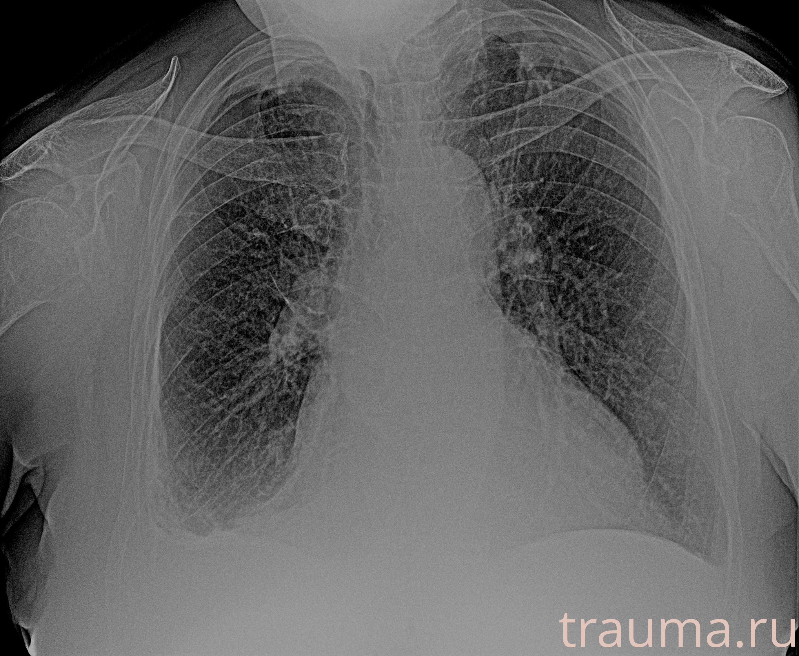 Рентген на дому: по вашему адресу приезжает врач-рентгенолог, травматолог-ортопед с мобильным рентгеновским аппаратом, проводит диагностику травмы или заболевания, делает необходимые рентгенограммы, дает рекомендации по дальнейшему лечению. Получить качественные снимки в домашних условиях возможно благодаря уникальной методике, разработанной МосРентген Центром для института  Склифосовского