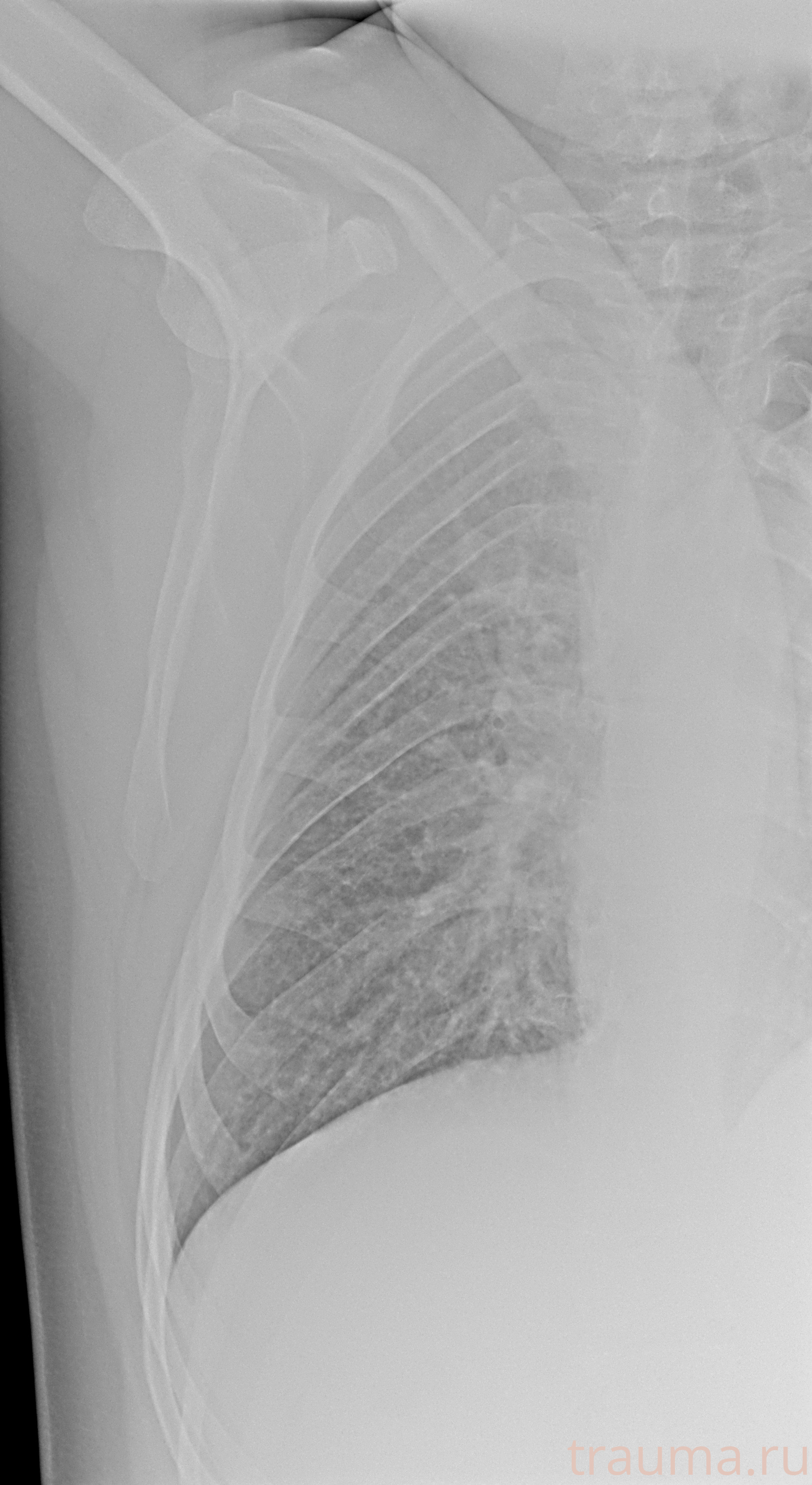 Рентген на дому: по вашему адресу приезжает врач-рентгенолог, травматолог-ортопед с мобильным рентгеновским аппаратом, проводит диагностику травмы или заболевания, делает необходимые рентгенограммы, дает рекомендации по дальнейшему лечению. Получить качественные снимки в домашних условиях возможно благодаря уникальной методике, разработанной МосРентген Центром для института  Склифосовского