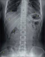 Получение снимка с беспроводного DR-детектора в программе для цифровой рентгенографии Image Suite версии 4.0 Получение снимка с беспроводного DR-детектора в программе для цифровой рентгенографии Image Suite версии 4.0