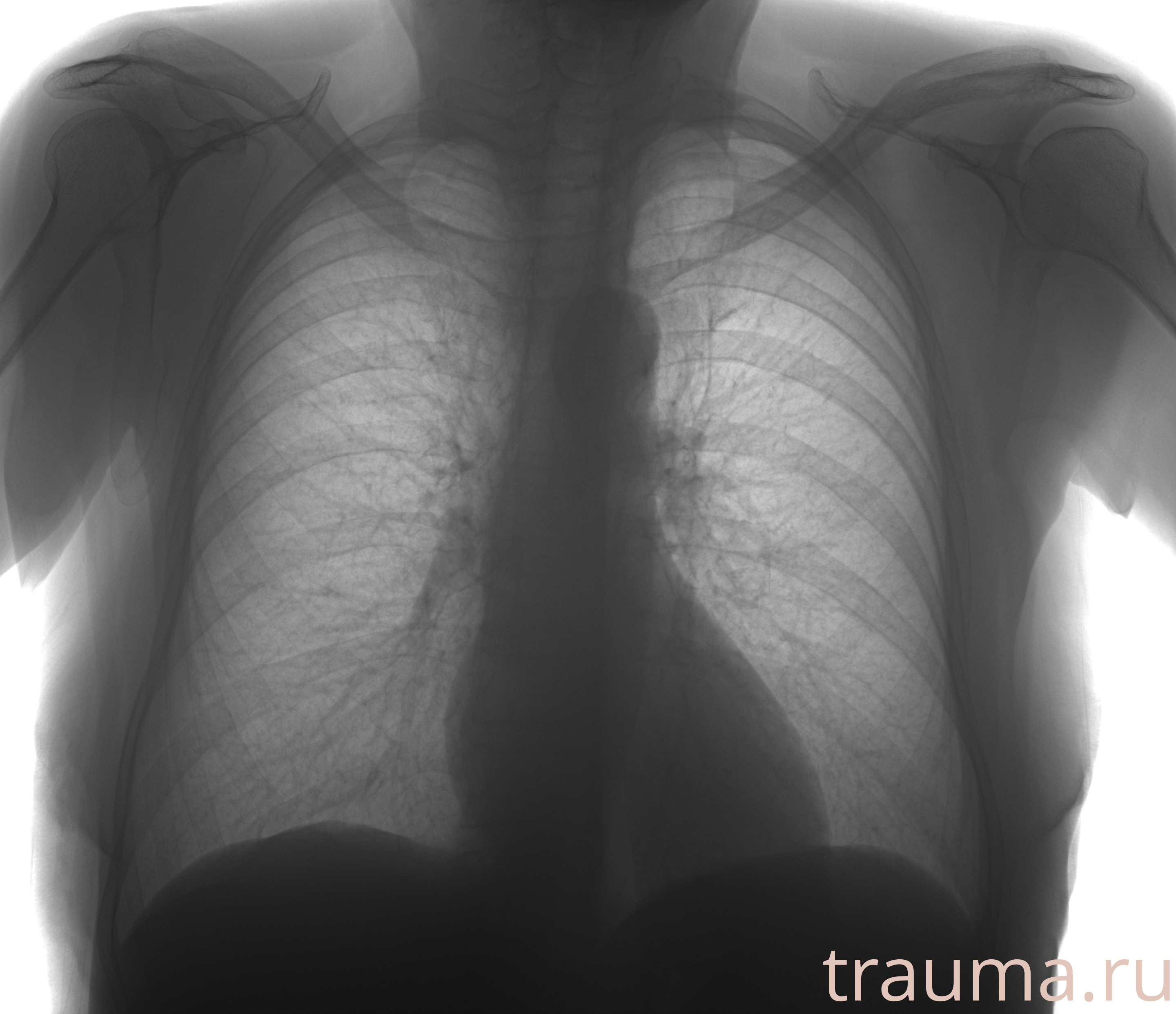 Рентген на дому: по вашему адресу приезжает врач-рентгенолог, травматолог-ортопед с мобильным рентгеновским аппаратом, проводит диагностику травмы или заболевания, делает необходимые рентгенограммы, дает рекомендации по дальнейшему лечению. Получить качественные снимки в домашних условиях возможно благодаря уникальной методике, разработанной МосРентген Центром для института  Склифосовского