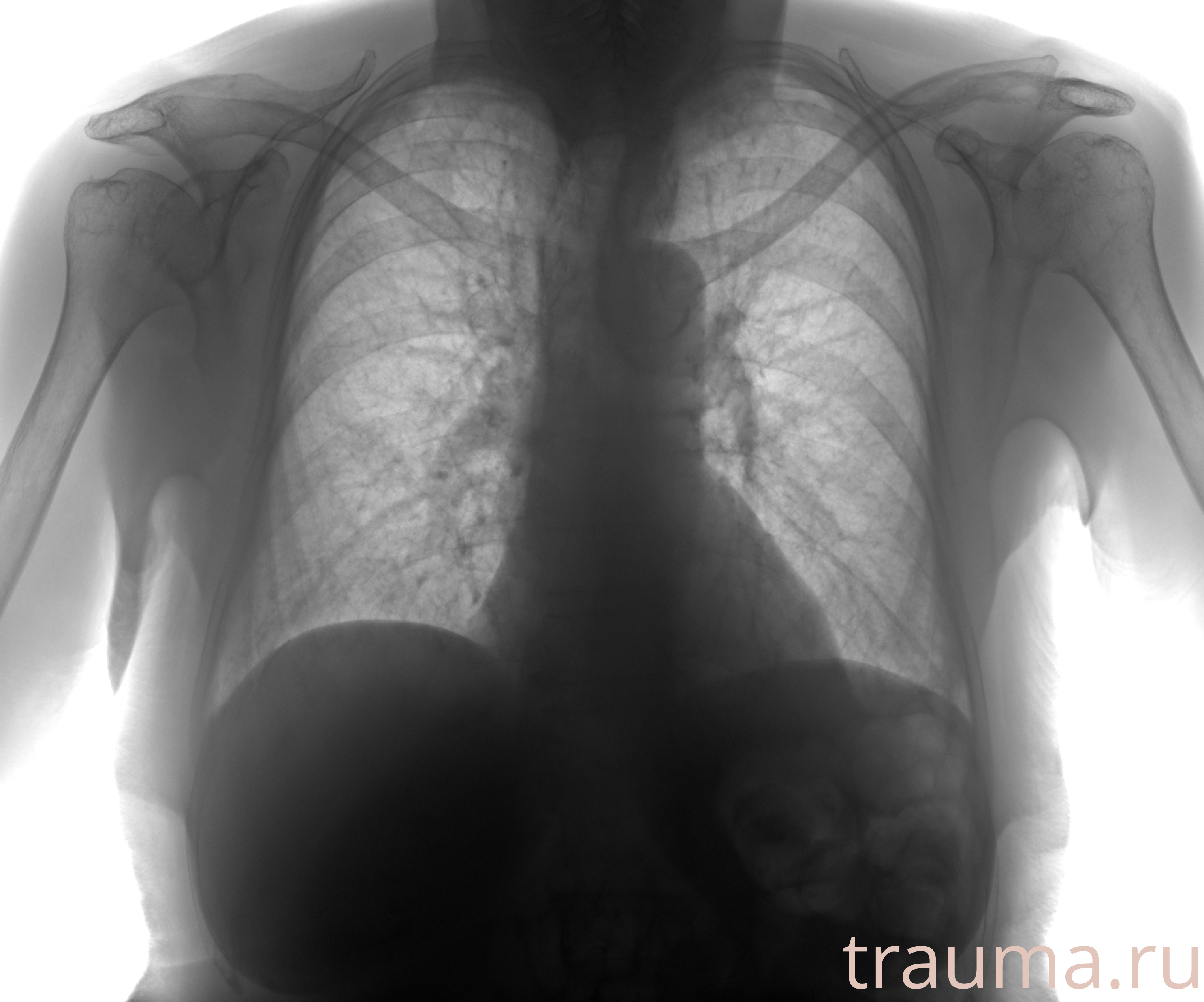 Рентген на дому: по вашему адресу приезжает врач-рентгенолог, травматолог-ортопед с мобильным рентгеновским аппаратом, проводит диагностику травмы или заболевания, делает необходимые рентгенограммы, дает рекомендации по дальнейшему лечению. Получить качественные снимки в домашних условиях возможно благодаря уникальной методике, разработанной МосРентген Центром для института  Склифосовского