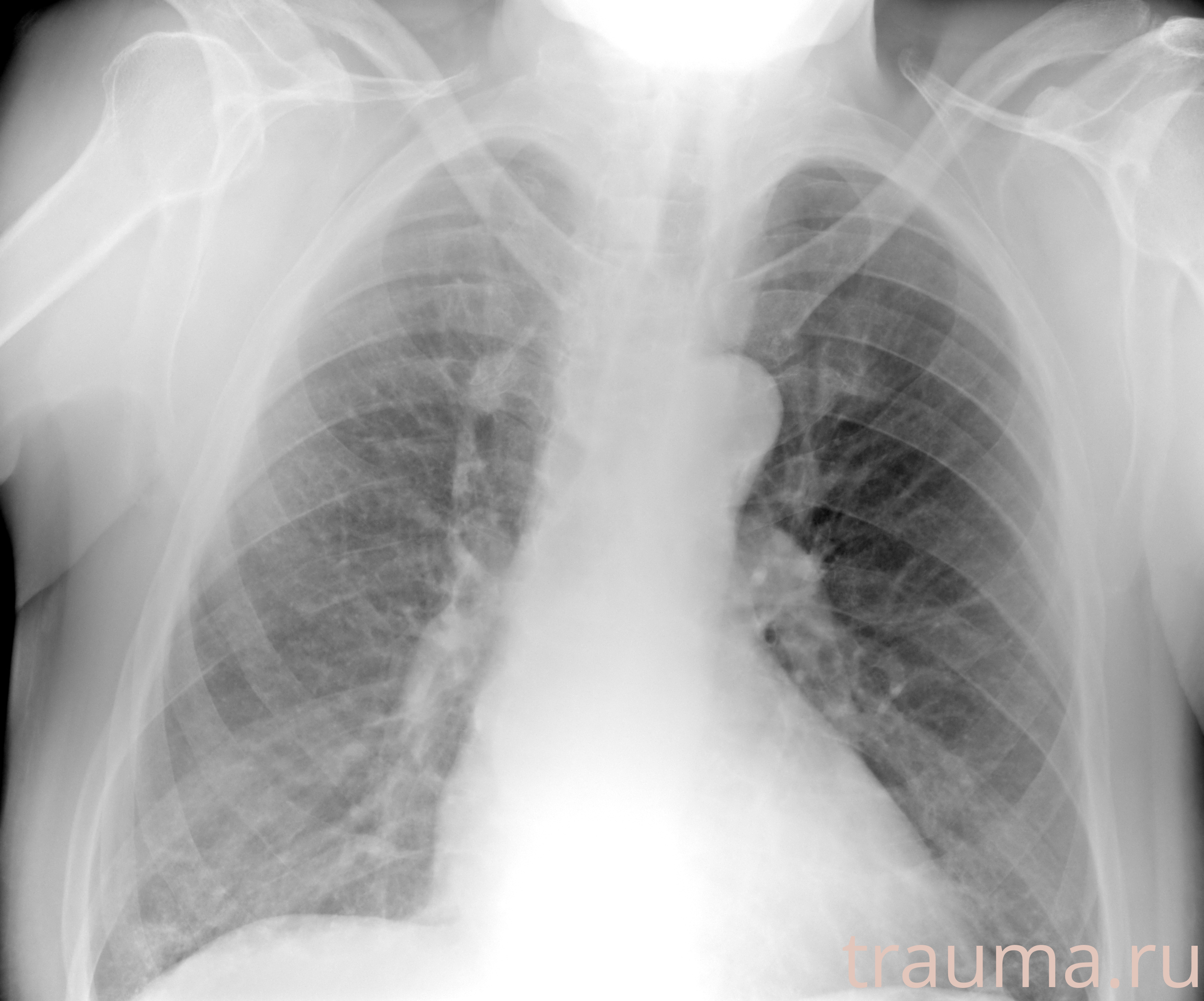 Рентген на дому: по вашему адресу приезжает врач-рентгенолог, травматолог-ортопед с мобильным рентгеновским аппаратом, проводит диагностику травмы или заболевания, делает необходимые рентгенограммы, дает рекомендации по дальнейшему лечению. Получить качественные снимки в домашних условиях возможно благодаря уникальной методике, разработанной МосРентген Центром для института  Склифосовского