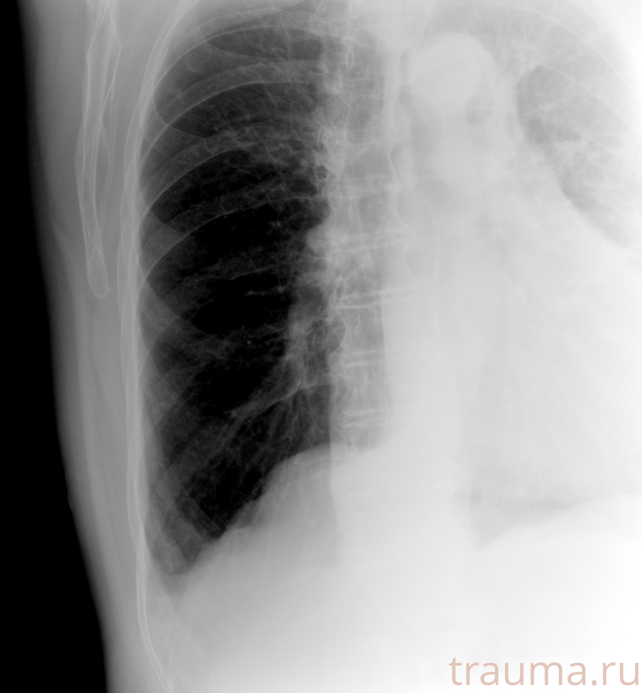 Рентген на дому: по вашему адресу приезжает врач-рентгенолог, травматолог-ортопед с мобильным рентгеновским аппаратом, проводит диагностику травмы или заболевания, делает необходимые рентгенограммы, дает рекомендации по дальнейшему лечению. Получить качественные снимки в домашних условиях возможно благодаря уникальной методике, разработанной МосРентген Центром для института  Склифосовского