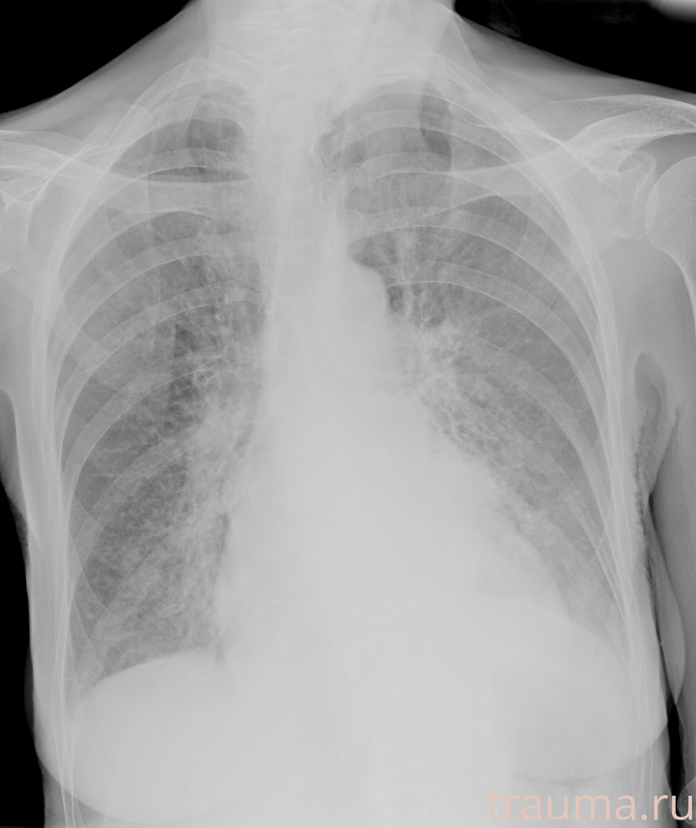 Рентген на дому: по вашему адресу приезжает врач-рентгенолог, травматолог-ортопед с мобильным рентгеновским аппаратом, проводит диагностику травмы или заболевания, делает необходимые рентгенограммы, дает рекомендации по дальнейшему лечению. Получить качественные снимки в домашних условиях возможно благодаря уникальной методике, разработанной МосРентген Центром для института  Склифосовского