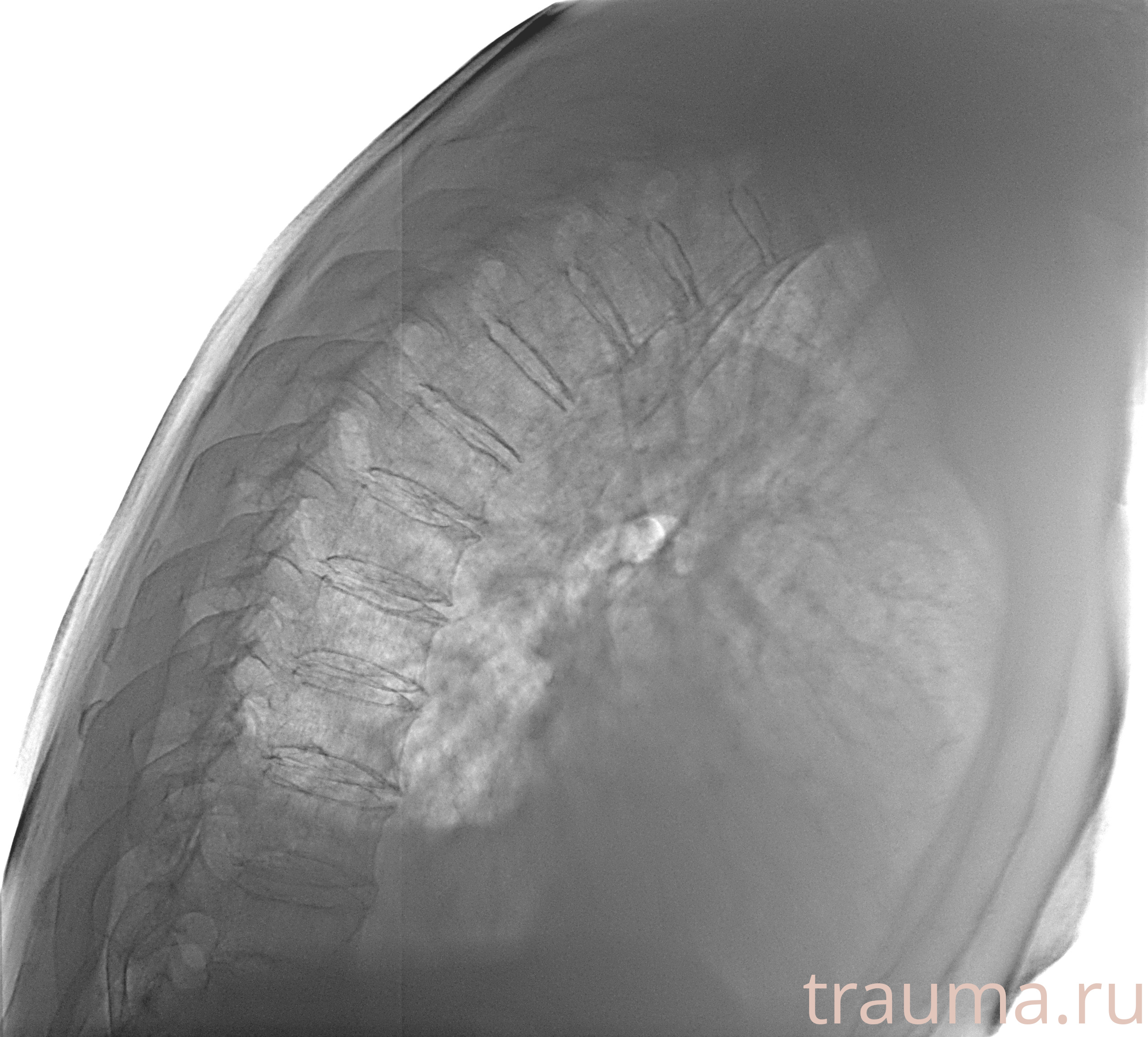 Рентген на дому: по вашему адресу приезжает врач-рентгенолог, травматолог-ортопед с мобильным рентгеновским аппаратом, проводит диагностику травмы или заболевания, делает необходимые рентгенограммы, дает рекомендации по дальнейшему лечению. Получить качественные снимки в домашних условиях возможно благодаря уникальной методике, разработанной МосРентген Центром для института  Склифосовского