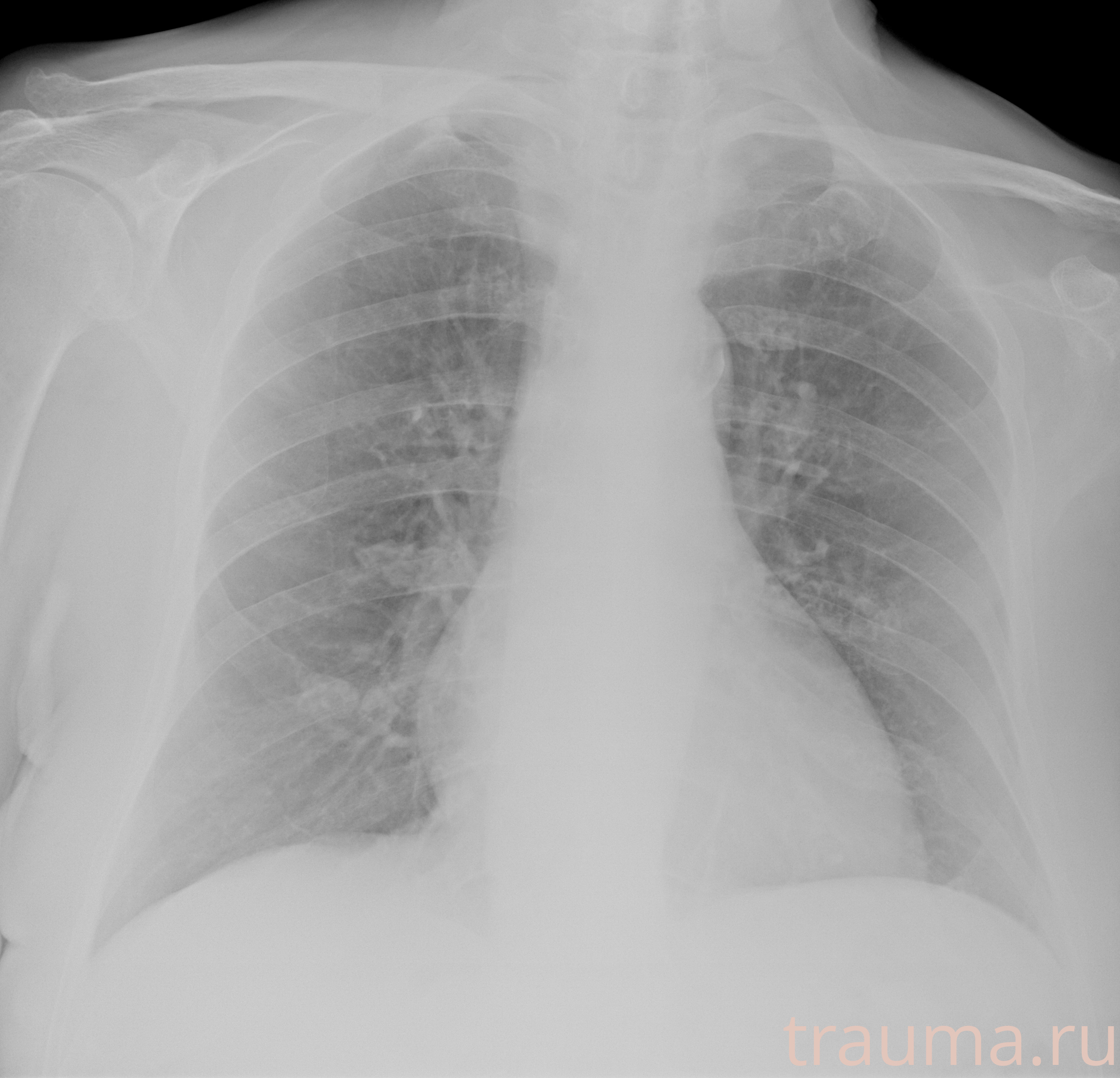 Рентген на дому: по вашему адресу приезжает врач-рентгенолог, травматолог-ортопед с мобильным рентгеновским аппаратом, проводит диагностику травмы или заболевания, делает необходимые рентгенограммы, дает рекомендации по дальнейшему лечению. Получить качественные снимки в домашних условиях возможно благодаря уникальной методике, разработанной МосРентген Центром для института  Склифосовского