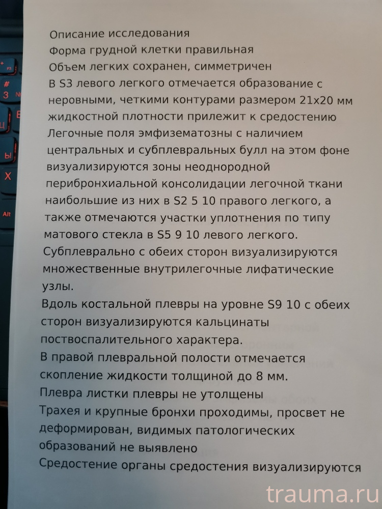 Рентген на дому: по вашему адресу приезжает врач-рентгенолог, травматолог-ортопед с мобильным рентгеновским аппаратом, проводит диагностику травмы или заболевания, делает необходимые рентгенограммы, дает рекомендации по дальнейшему лечению. Получить качественные снимки в домашних условиях возможно благодаря уникальной методике, разработанной МосРентген Центром для института  Склифосовского