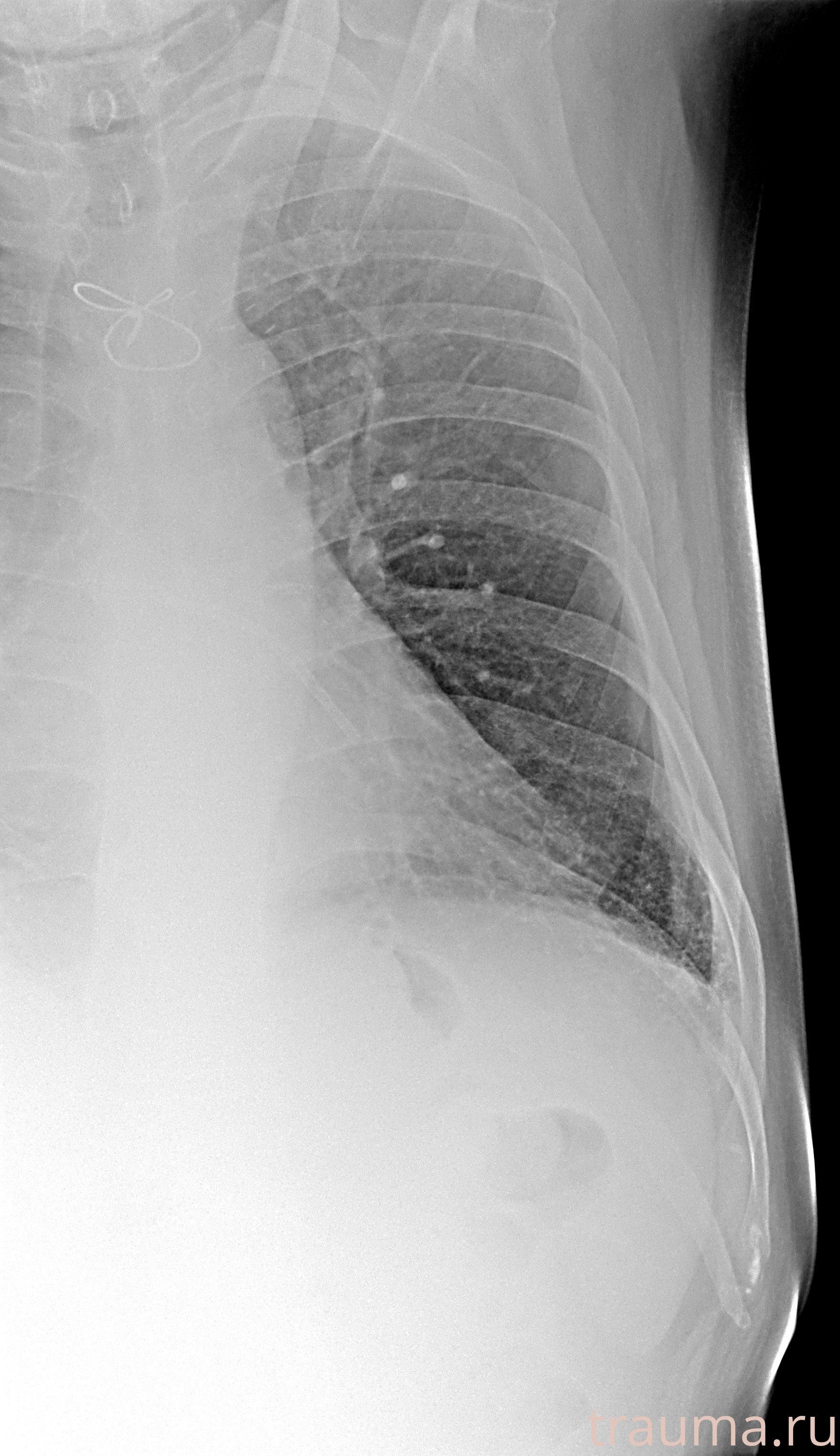 Рентген на дому: по вашему адресу приезжает врач-рентгенолог, травматолог-ортопед с мобильным рентгеновским аппаратом, проводит диагностику травмы или заболевания, делает необходимые рентгенограммы, дает рекомендации по дальнейшему лечению. Получить качественные снимки в домашних условиях возможно благодаря уникальной методике, разработанной МосРентген Центром для института  Склифосовского