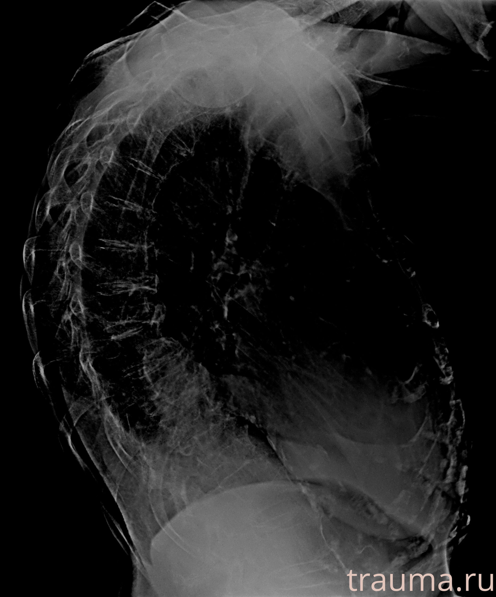 Рентген на дому: по вашему адресу приезжает врач-рентгенолог, травматолог-ортопед с мобильным рентгеновским аппаратом, проводит диагностику травмы или заболевания, делает необходимые рентгенограммы, дает рекомендации по дальнейшему лечению. Получить качественные снимки в домашних условиях возможно благодаря уникальной методике, разработанной МосРентген Центром для института  Склифосовского