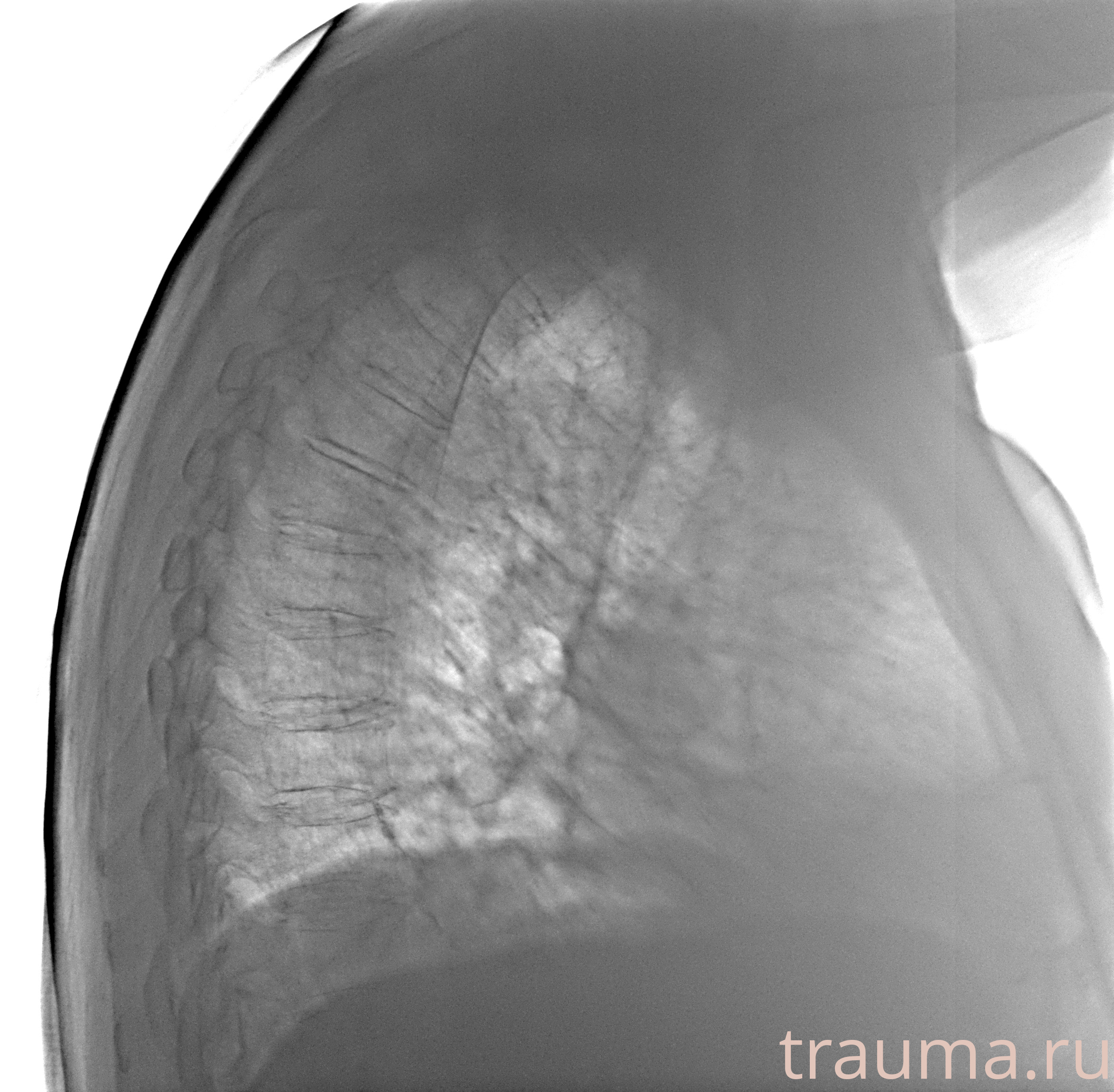 Рентген на дому: по вашему адресу приезжает врач-рентгенолог, травматолог-ортопед с мобильным рентгеновским аппаратом, проводит диагностику травмы или заболевания, делает необходимые рентгенограммы, дает рекомендации по дальнейшему лечению. Получить качественные снимки в домашних условиях возможно благодаря уникальной методике, разработанной МосРентген Центром для института  Склифосовского