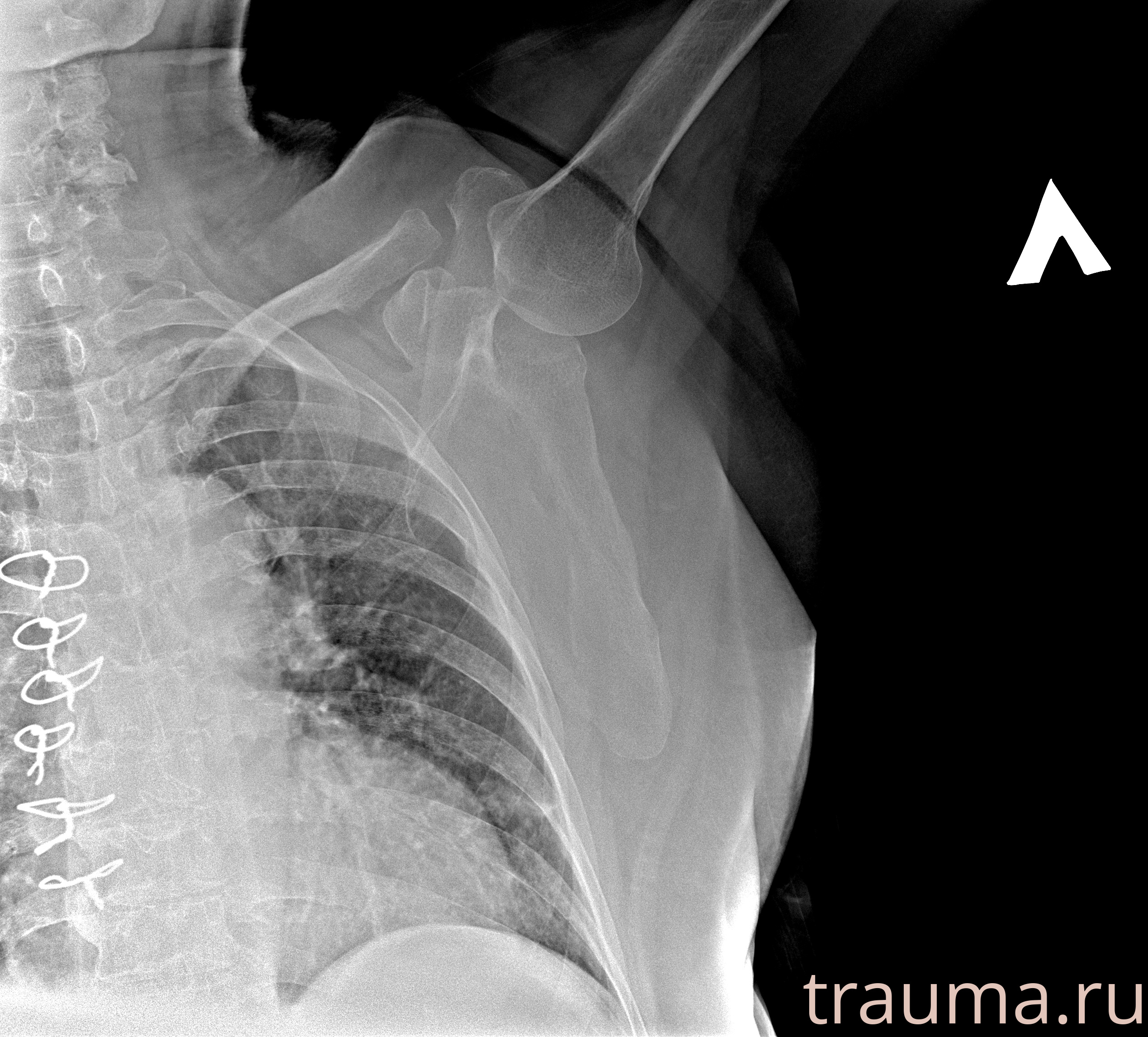 Рентген на дому: по вашему адресу приезжает врач-рентгенолог, травматолог-ортопед с мобильным рентгеновским аппаратом, проводит диагностику травмы или заболевания, делает необходимые рентгенограммы, дает рекомендации по дальнейшему лечению. Получить качественные снимки в домашних условиях возможно благодаря уникальной методике, разработанной МосРентген Центром для института  Склифосовского