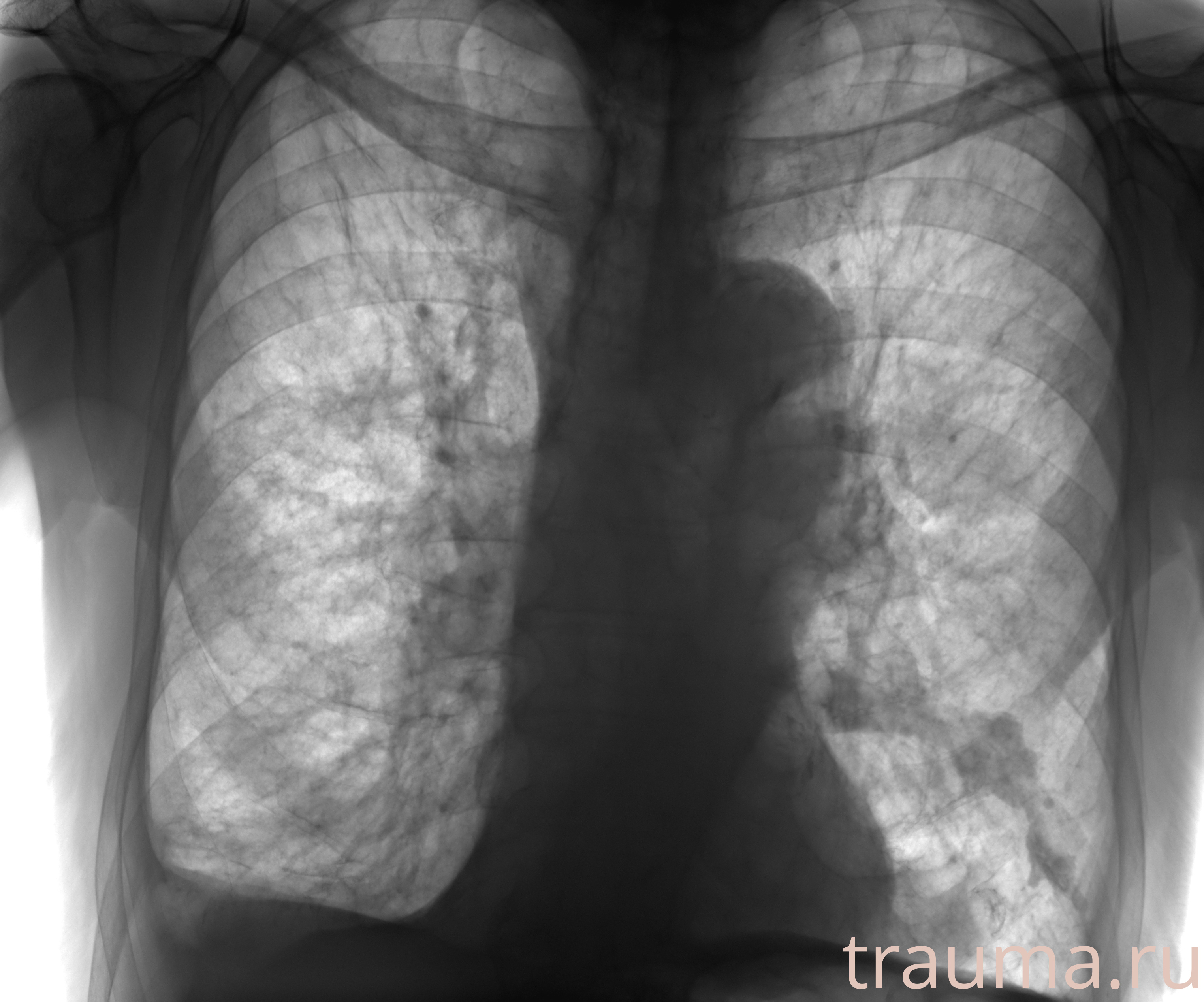 Рентген на дому: по вашему адресу приезжает врач-рентгенолог, травматолог-ортопед с мобильным рентгеновским аппаратом, проводит диагностику травмы или заболевания, делает необходимые рентгенограммы, дает рекомендации по дальнейшему лечению. Получить качественные снимки в домашних условиях возможно благодаря уникальной методике, разработанной МосРентген Центром для института  Склифосовского