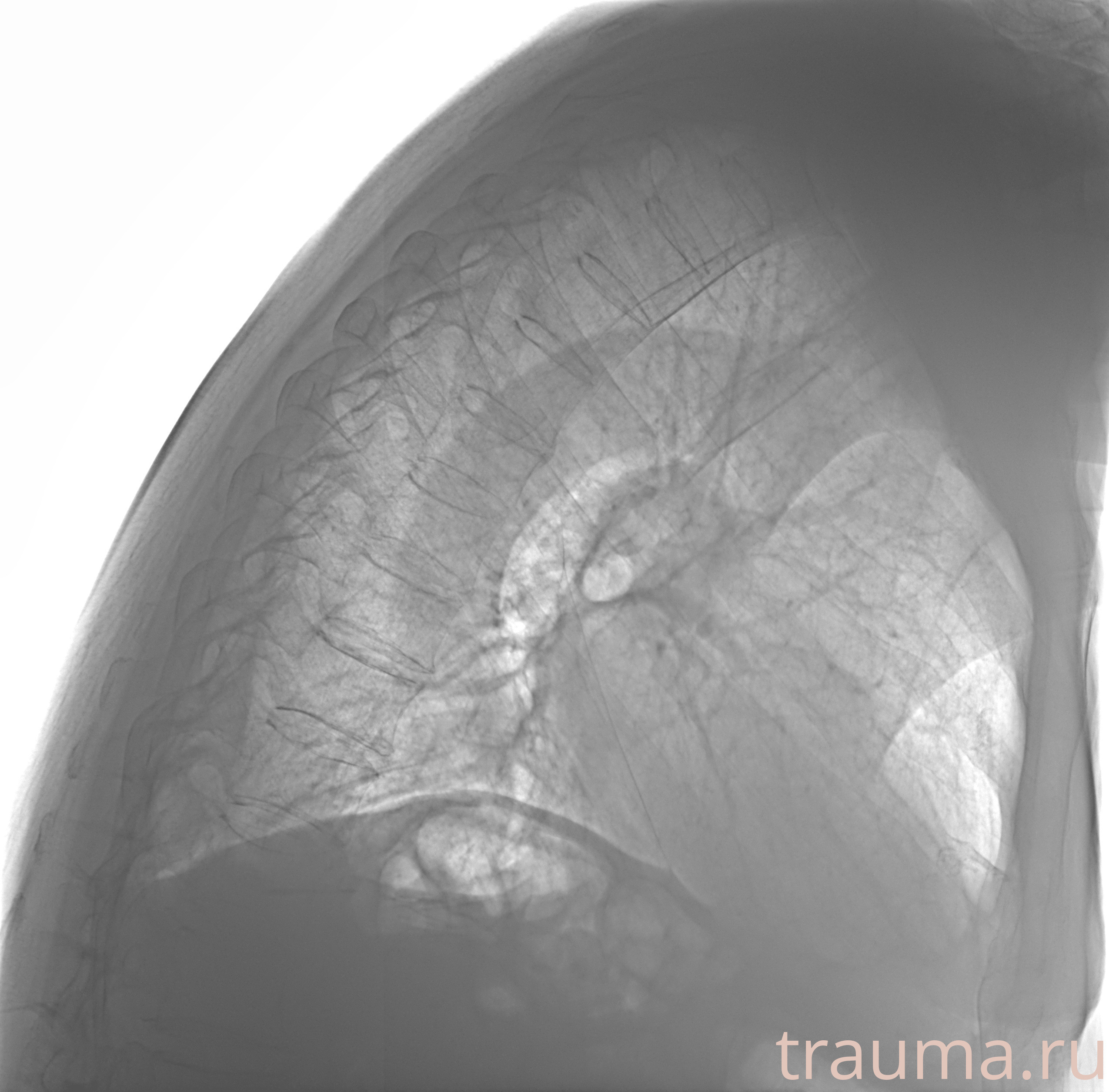 Рентген на дому: по вашему адресу приезжает врач-рентгенолог, травматолог-ортопед с мобильным рентгеновским аппаратом, проводит диагностику травмы или заболевания, делает необходимые рентгенограммы, дает рекомендации по дальнейшему лечению. Получить качественные снимки в домашних условиях возможно благодаря уникальной методике, разработанной МосРентген Центром для института  Склифосовского