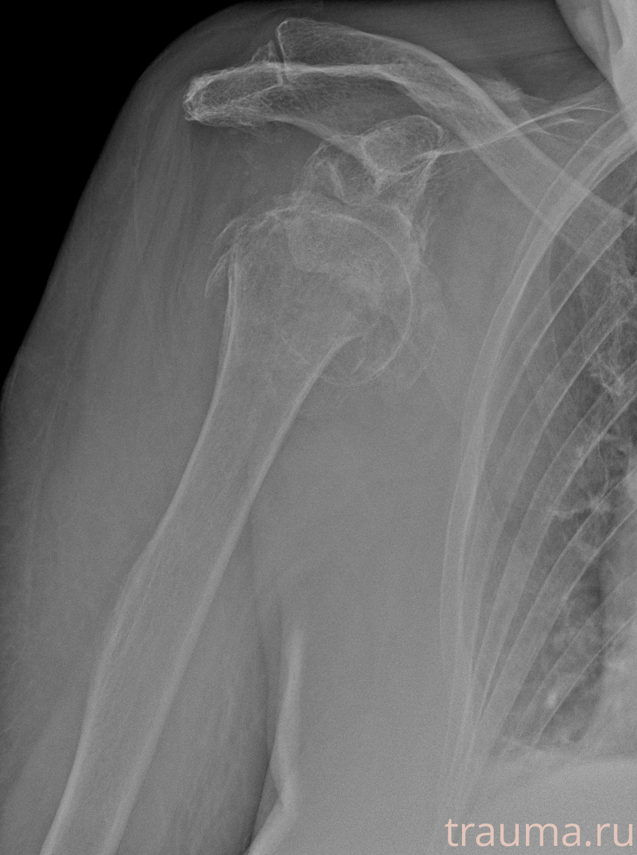 Рентген на дому: по вашему адресу приезжает врач-рентгенолог, травматолог-ортопед с мобильным рентгеновским аппаратом, проводит диагностику травмы или заболевания, делает необходимые рентгенограммы, дает рекомендации по дальнейшему лечению. Получить качественные снимки в домашних условиях возможно благодаря уникальной методике, разработанной МосРентген Центром для института  Склифосовского