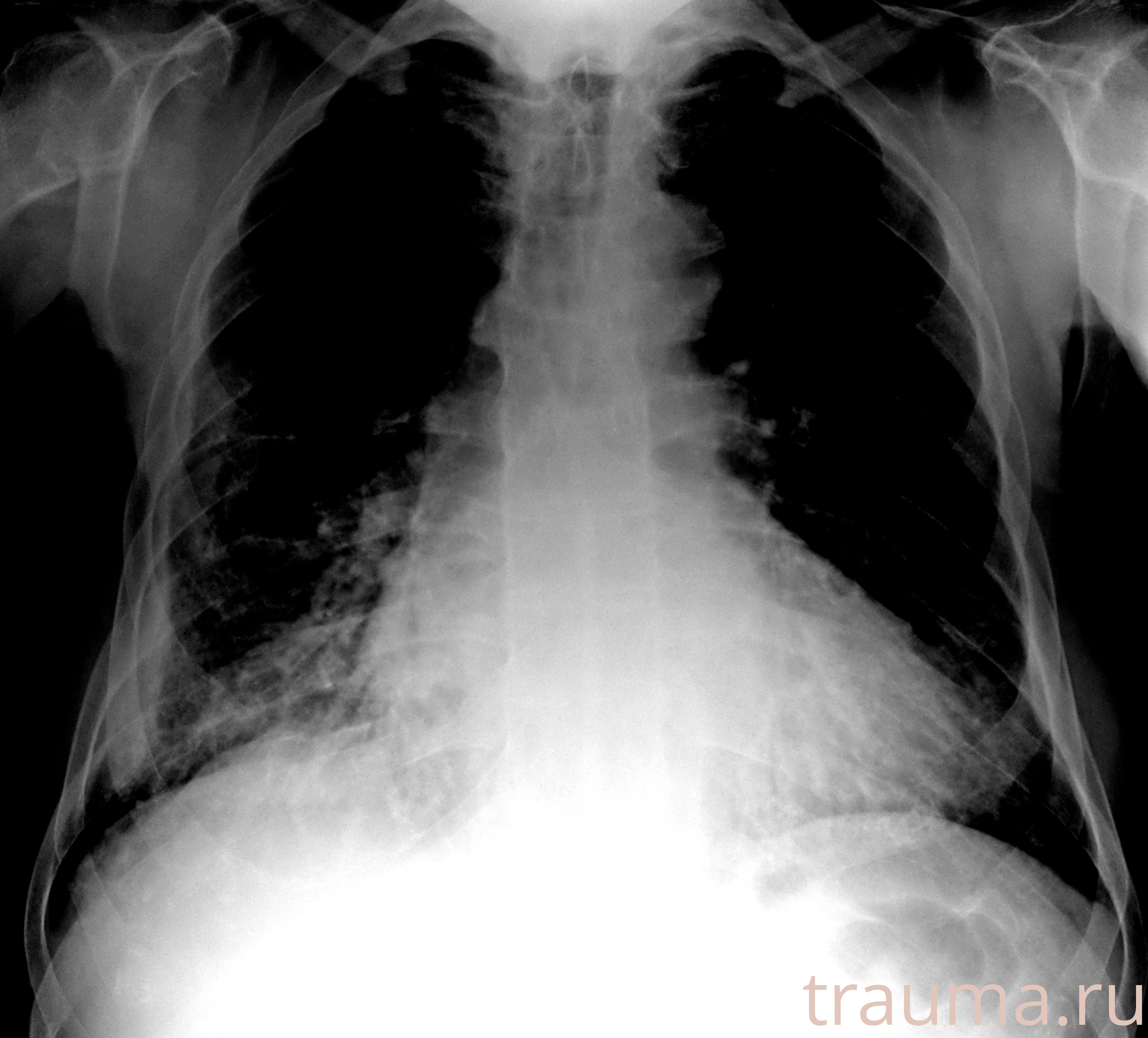 Рентген на дому: по вашему адресу приезжает врач-рентгенолог, травматолог-ортопед с мобильным рентгеновским аппаратом, проводит диагностику травмы или заболевания, делает необходимые рентгенограммы, дает рекомендации по дальнейшему лечению. Получить качественные снимки в домашних условиях возможно благодаря уникальной методике, разработанной МосРентген Центром для института  Склифосовского