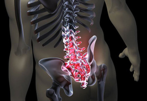 Постуральные изменения позвоночно-тазового баланса у пациентов с hip-spine синдромом Постуральные изменения позвоночно-тазового баланса у пациентов с hip-spine синдромом