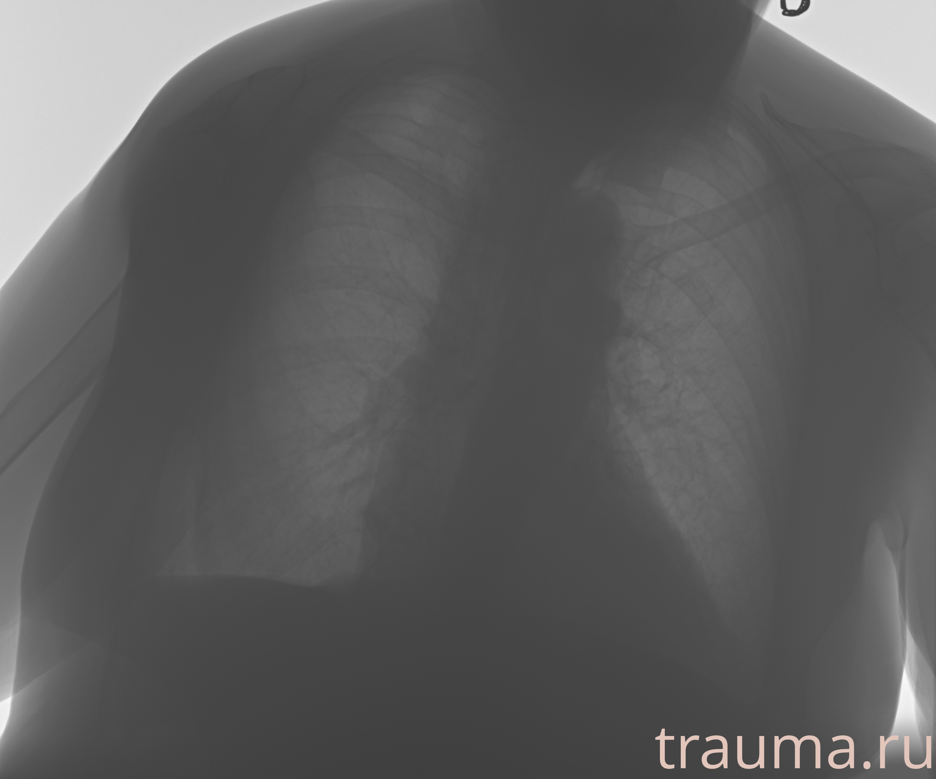 Рентген на дому: по вашему адресу приезжает врач-рентгенолог, травматолог-ортопед с мобильным рентгеновским аппаратом, проводит диагностику травмы или заболевания, делает необходимые рентгенограммы, дает рекомендации по дальнейшему лечению. Получить качественные снимки в домашних условиях возможно благодаря уникальной методике, разработанной МосРентген Центром для института  Склифосовского