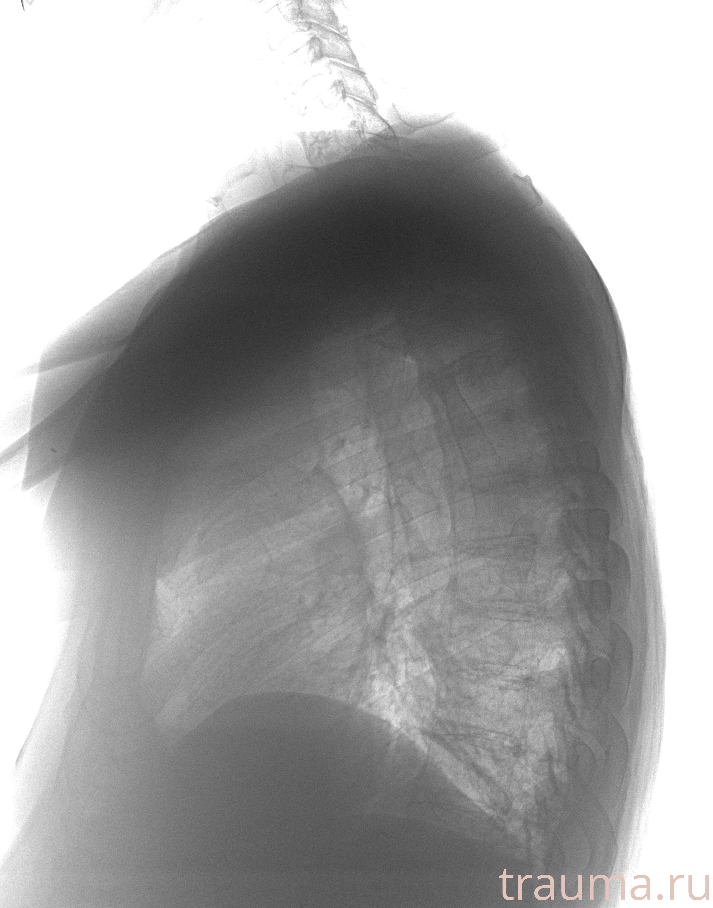 Рентген на дому: по вашему адресу приезжает врач-рентгенолог, травматолог-ортопед с мобильным рентгеновским аппаратом, проводит диагностику травмы или заболевания, делает необходимые рентгенограммы, дает рекомендации по дальнейшему лечению. Получить качественные снимки в домашних условиях возможно благодаря уникальной методике, разработанной МосРентген Центром для института  Склифосовского