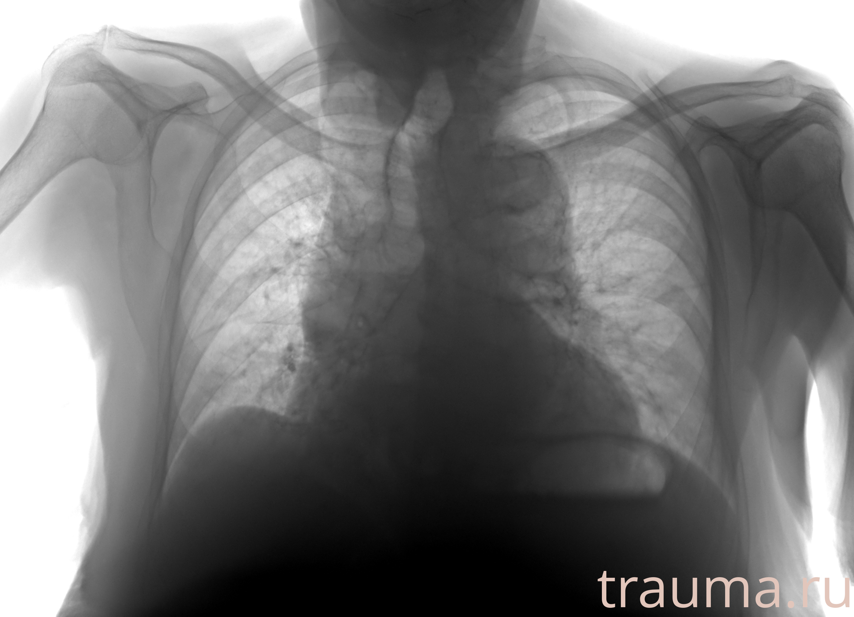 Рентген на дому: по вашему адресу приезжает врач-рентгенолог, травматолог-ортопед с мобильным рентгеновским аппаратом, проводит диагностику травмы или заболевания, делает необходимые рентгенограммы, дает рекомендации по дальнейшему лечению. Получить качественные снимки в домашних условиях возможно благодаря уникальной методике, разработанной МосРентген Центром для института  Склифосовского