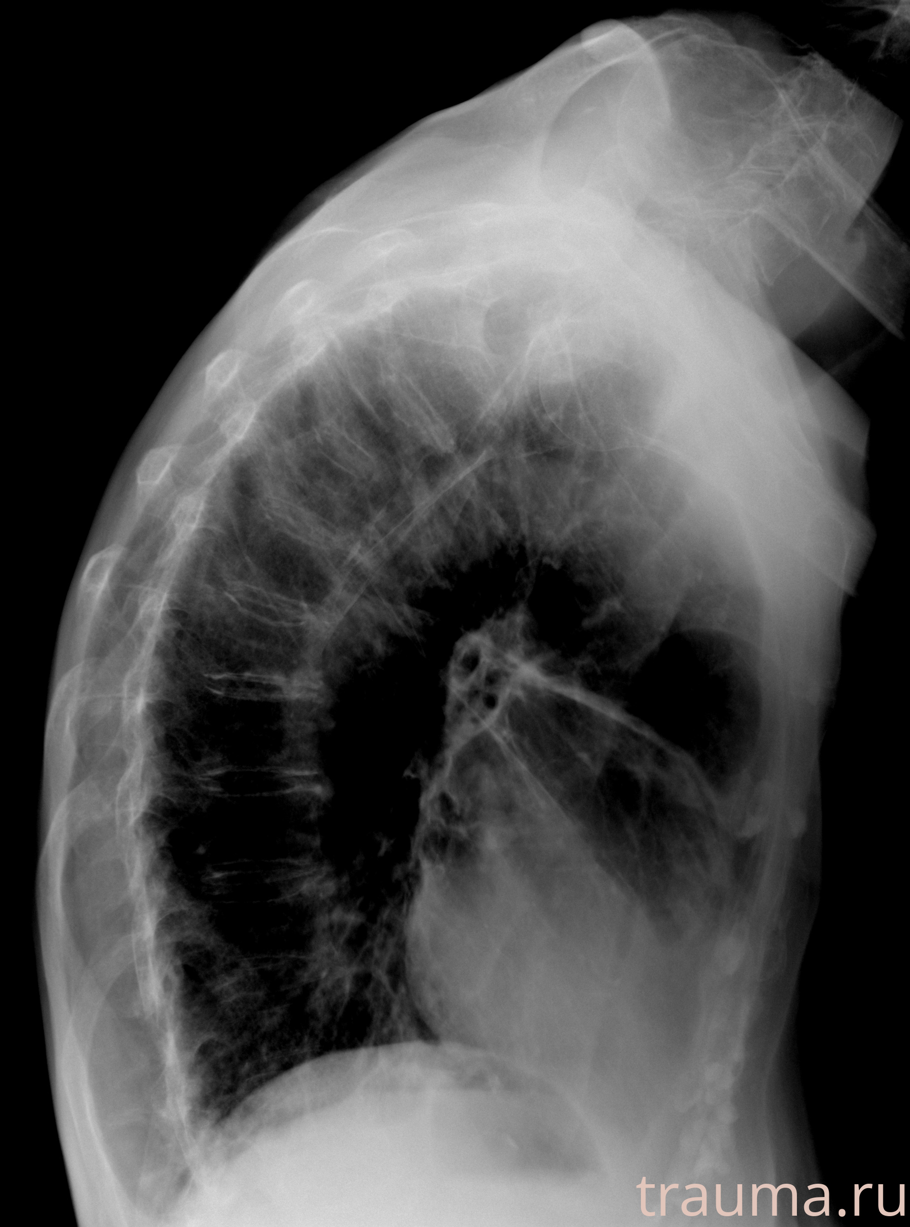 Рентген на дому: по вашему адресу приезжает врач-рентгенолог, травматолог-ортопед с мобильным рентгеновским аппаратом, проводит диагностику травмы или заболевания, делает необходимые рентгенограммы, дает рекомендации по дальнейшему лечению. Получить качественные снимки в домашних условиях возможно благодаря уникальной методике, разработанной МосРентген Центром для института  Склифосовского