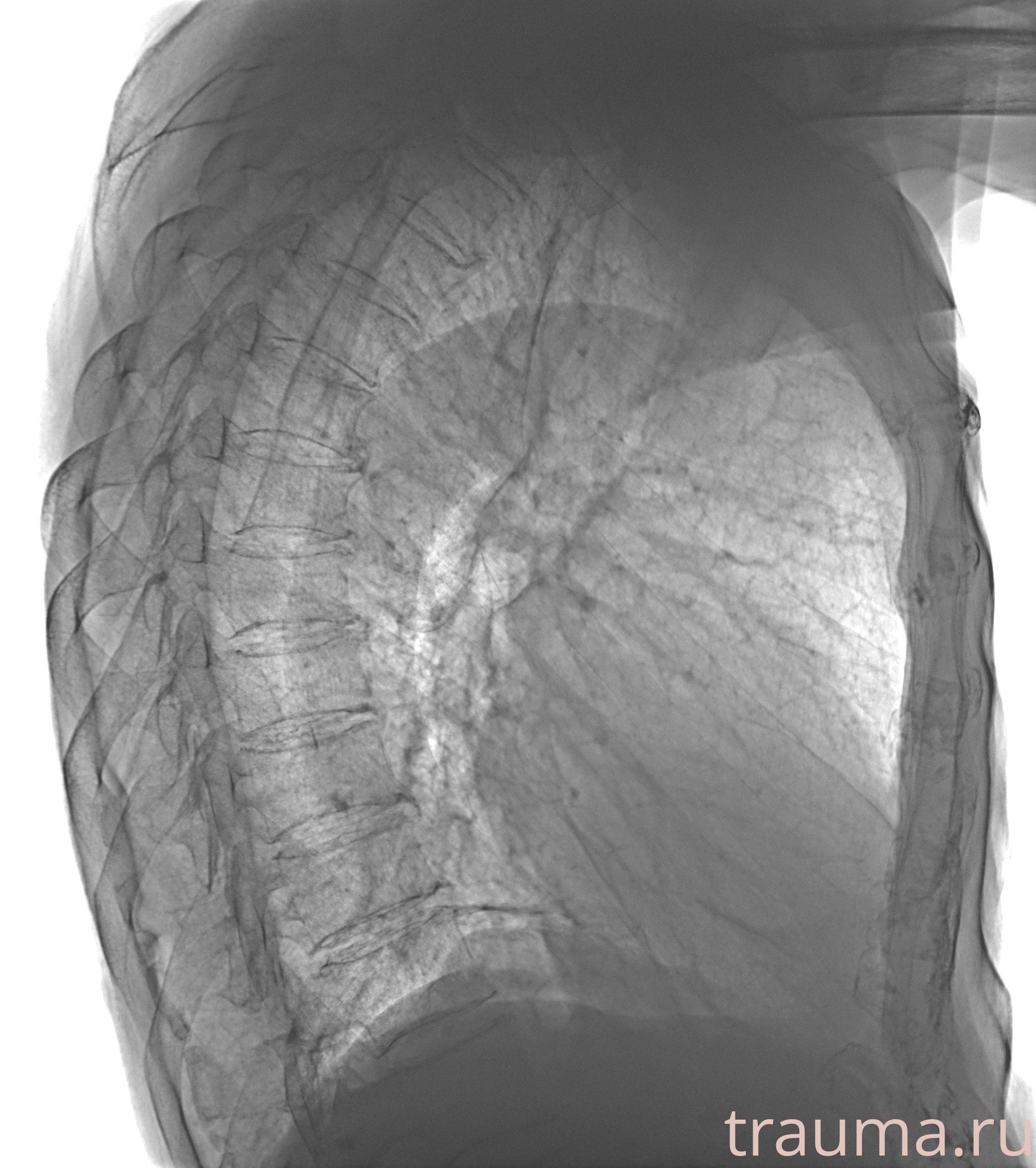 Рентген на дому: по вашему адресу приезжает врач-рентгенолог, травматолог-ортопед с мобильным рентгеновским аппаратом, проводит диагностику травмы или заболевания, делает необходимые рентгенограммы, дает рекомендации по дальнейшему лечению. Получить качественные снимки в домашних условиях возможно благодаря уникальной методике, разработанной МосРентген Центром для института  Склифосовского