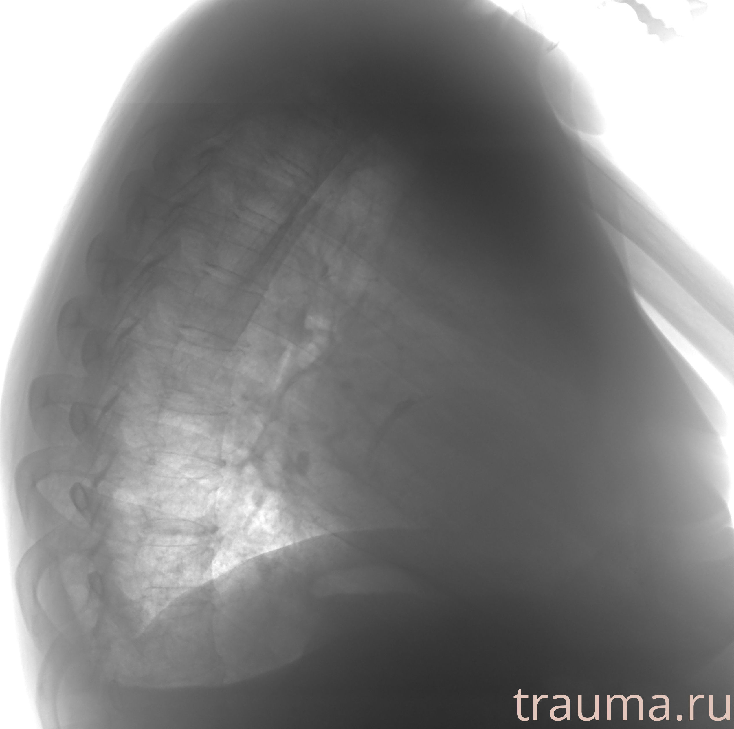 Рентген на дому: по вашему адресу приезжает врач-рентгенолог, травматолог-ортопед с мобильным рентгеновским аппаратом, проводит диагностику травмы или заболевания, делает необходимые рентгенограммы, дает рекомендации по дальнейшему лечению. Получить качественные снимки в домашних условиях возможно благодаря уникальной методике, разработанной МосРентген Центром для института  Склифосовского