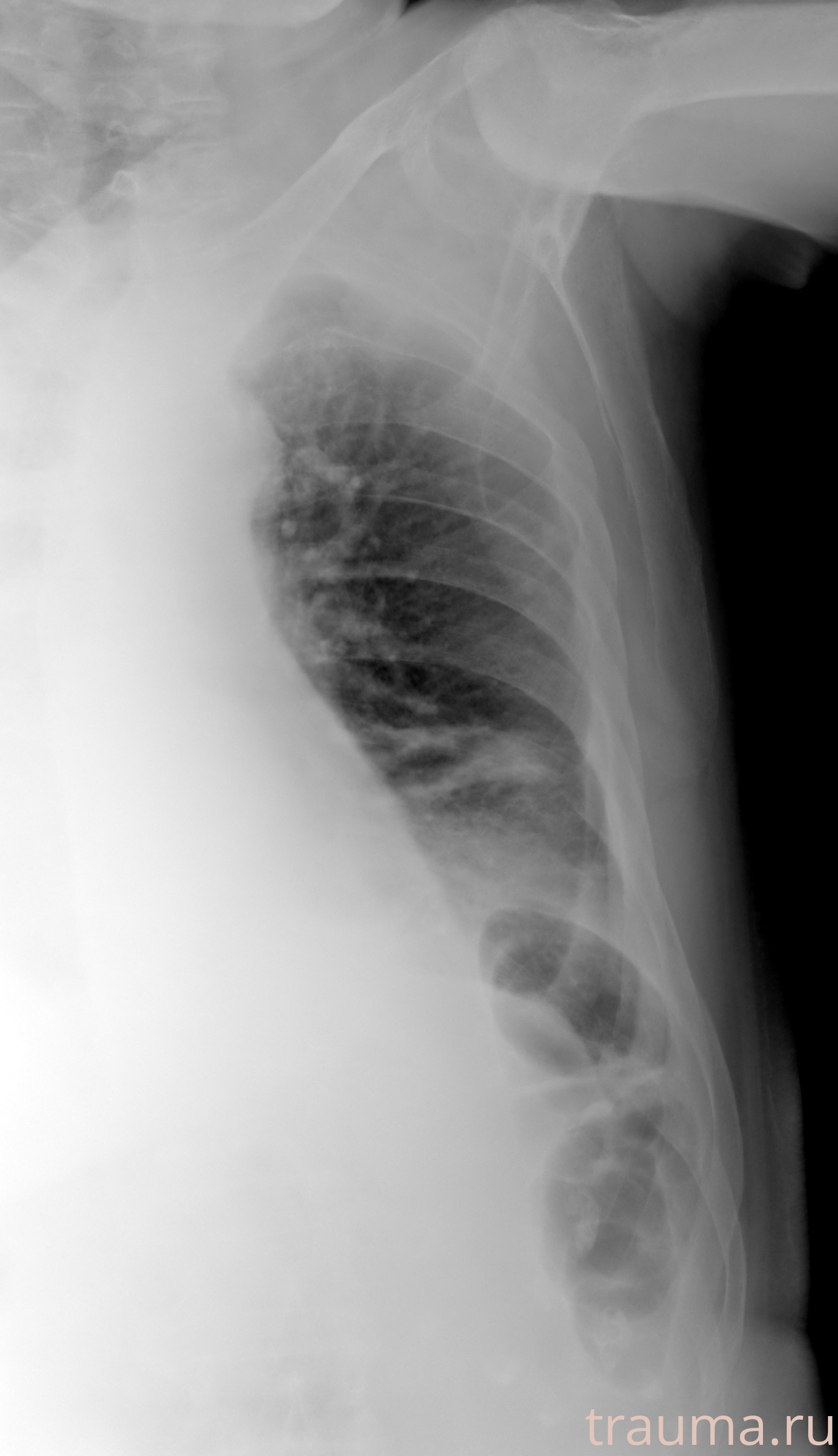 Рентген на дому: по вашему адресу приезжает врач-рентгенолог, травматолог-ортопед с мобильным рентгеновским аппаратом, проводит диагностику травмы или заболевания, делает необходимые рентгенограммы, дает рекомендации по дальнейшему лечению. Получить качественные снимки в домашних условиях возможно благодаря уникальной методике, разработанной МосРентген Центром для института  Склифосовского