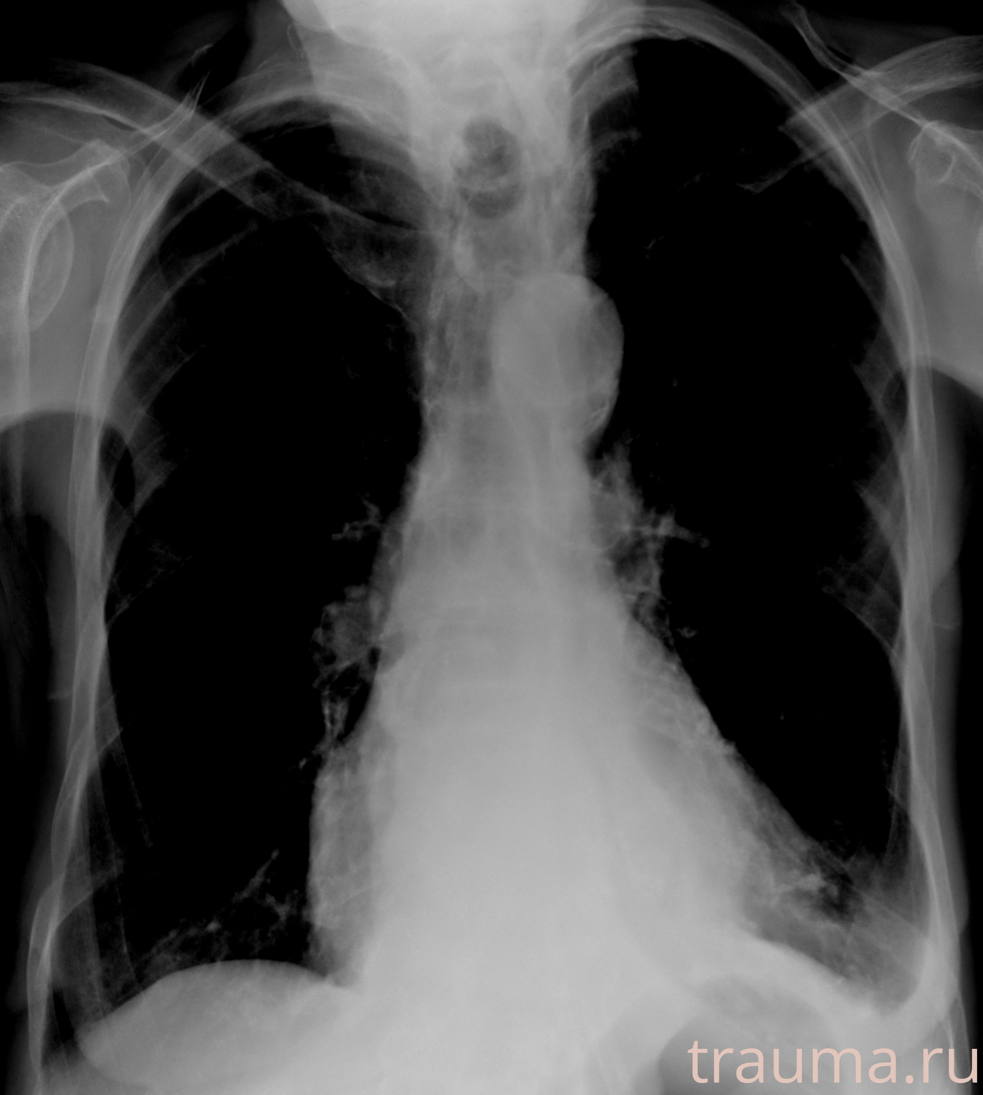 Рентген на дому: по вашему адресу приезжает врач-рентгенолог, травматолог-ортопед с мобильным рентгеновским аппаратом, проводит диагностику травмы или заболевания, делает необходимые рентгенограммы, дает рекомендации по дальнейшему лечению. Получить качественные снимки в домашних условиях возможно благодаря уникальной методике, разработанной МосРентген Центром для института  Склифосовского