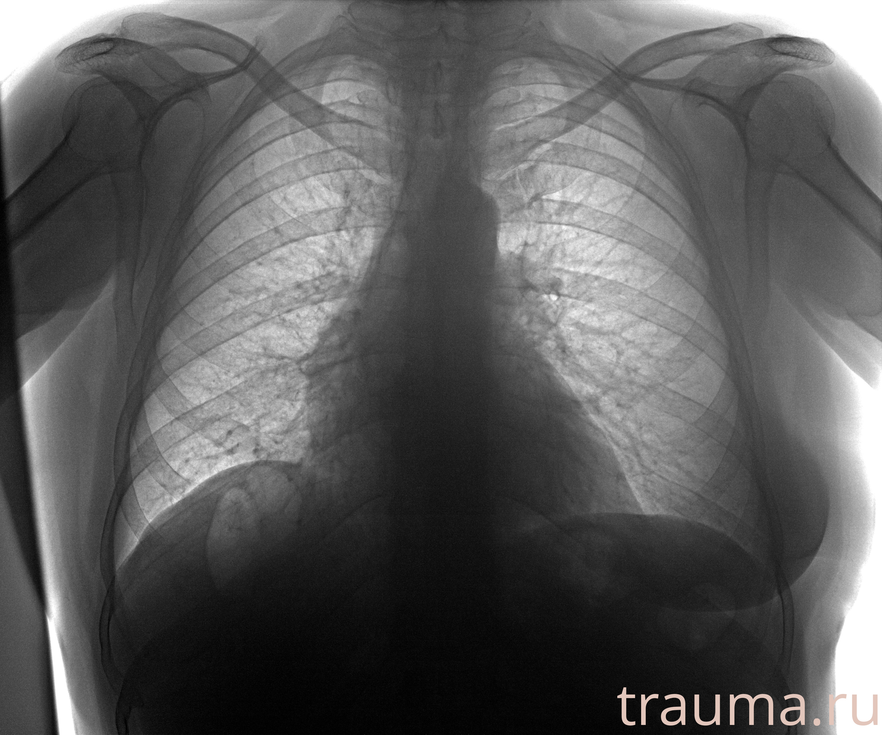 Рентген на дому: по вашему адресу приезжает врач-рентгенолог, травматолог-ортопед с мобильным рентгеновским аппаратом, проводит диагностику травмы или заболевания, делает необходимые рентгенограммы, дает рекомендации по дальнейшему лечению. Получить качественные снимки в домашних условиях возможно благодаря уникальной методике, разработанной МосРентген Центром для института  Склифосовского