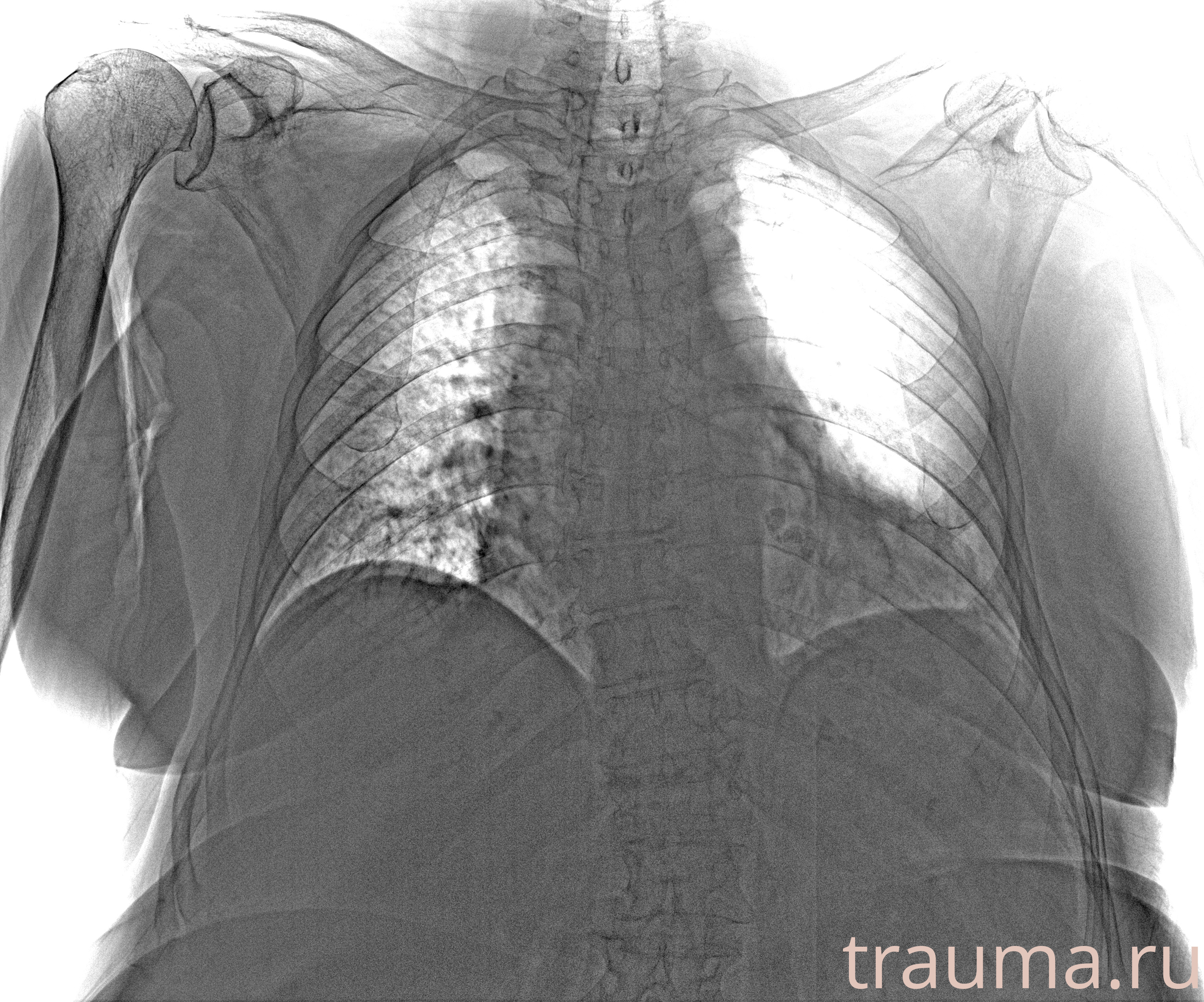 Рентген на дому: по вашему адресу приезжает врач-рентгенолог, травматолог-ортопед с мобильным рентгеновским аппаратом, проводит диагностику травмы или заболевания, делает необходимые рентгенограммы, дает рекомендации по дальнейшему лечению. Получить качественные снимки в домашних условиях возможно благодаря уникальной методике, разработанной МосРентген Центром для института  Склифосовского