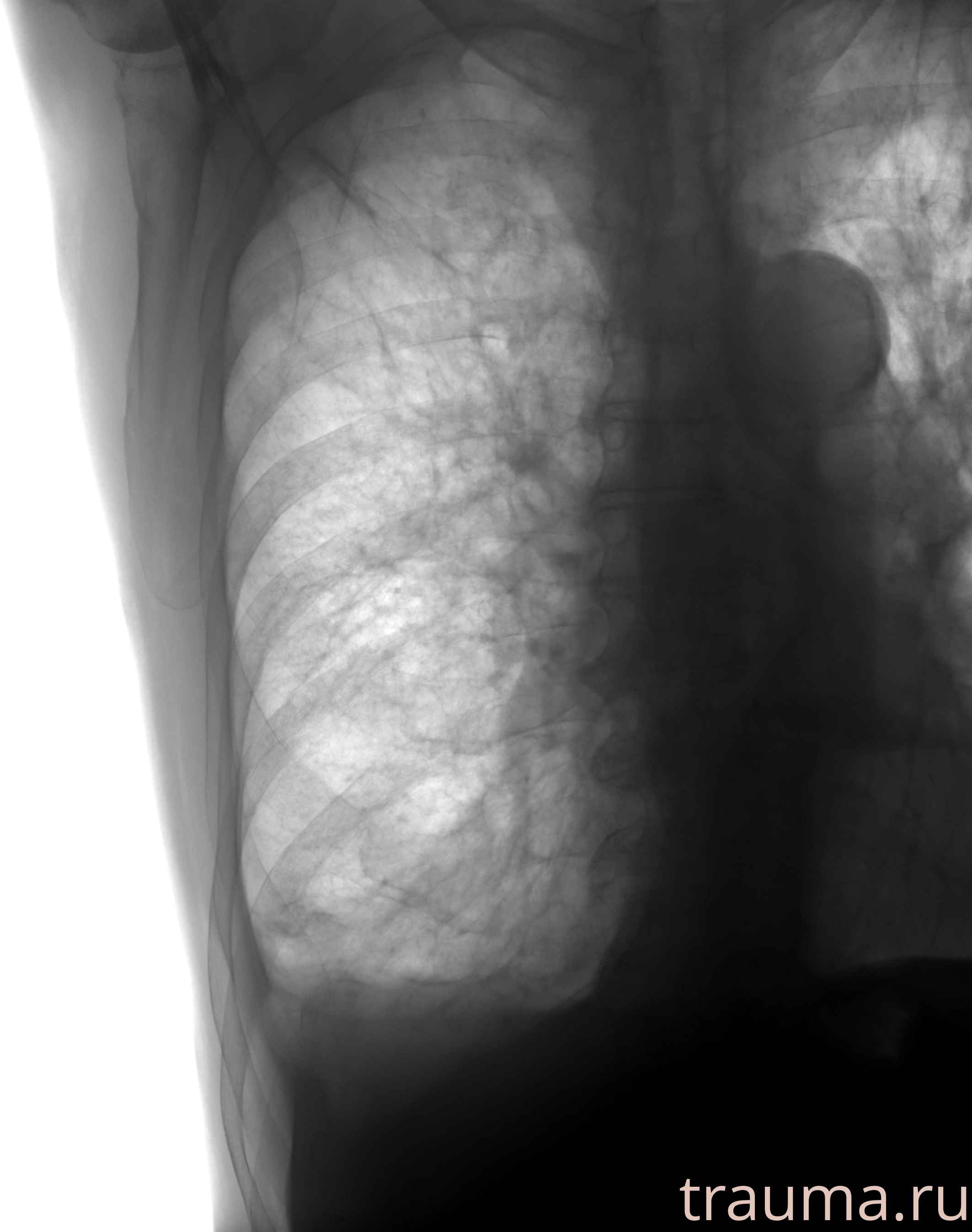 Рентген на дому: по вашему адресу приезжает врач-рентгенолог, травматолог-ортопед с мобильным рентгеновским аппаратом, проводит диагностику травмы или заболевания, делает необходимые рентгенограммы, дает рекомендации по дальнейшему лечению. Получить качественные снимки в домашних условиях возможно благодаря уникальной методике, разработанной МосРентген Центром для института  Склифосовского