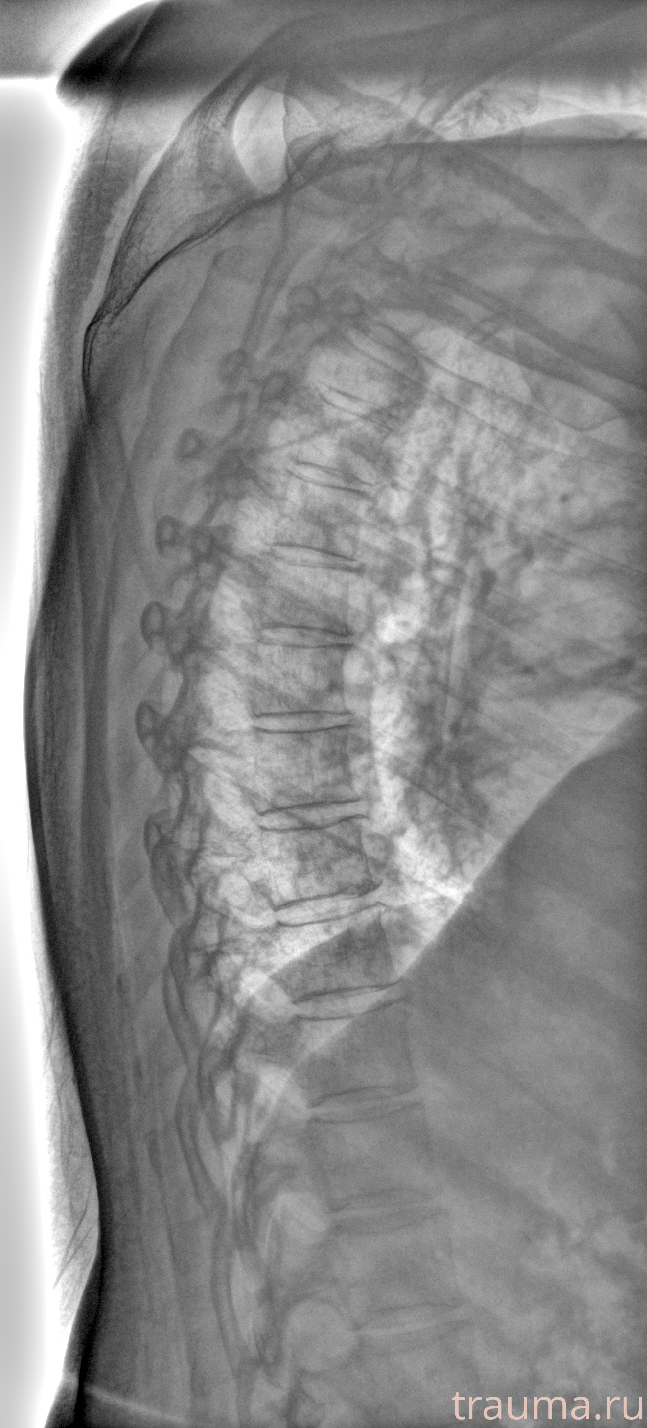 Рентген на дому: по вашему адресу приезжает врач-рентгенолог, травматолог-ортопед с мобильным рентгеновским аппаратом, проводит диагностику травмы или заболевания, делает необходимые рентгенограммы, дает рекомендации по дальнейшему лечению. Получить качественные снимки в домашних условиях возможно благодаря уникальной методике, разработанной МосРентген Центром для института  Склифосовского