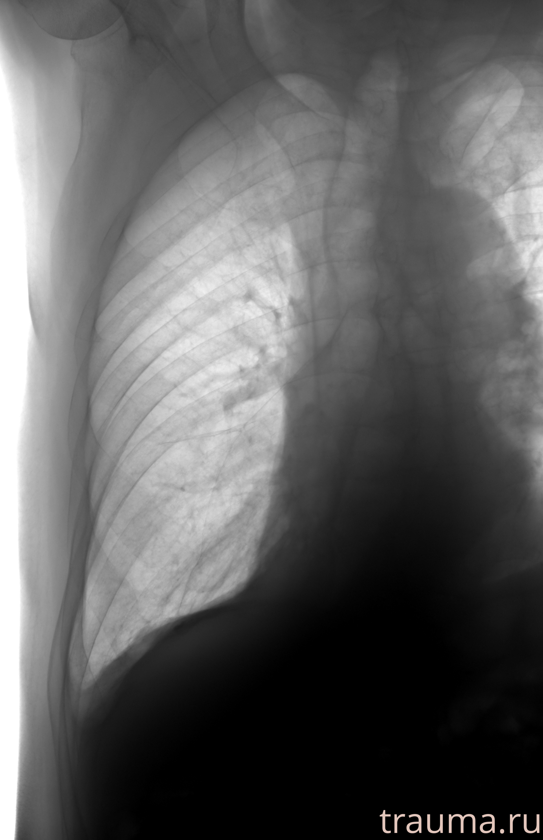 Рентген на дому: по вашему адресу приезжает врач-рентгенолог, травматолог-ортопед с мобильным рентгеновским аппаратом, проводит диагностику травмы или заболевания, делает необходимые рентгенограммы, дает рекомендации по дальнейшему лечению. Получить качественные снимки в домашних условиях возможно благодаря уникальной методике, разработанной МосРентген Центром для института  Склифосовского