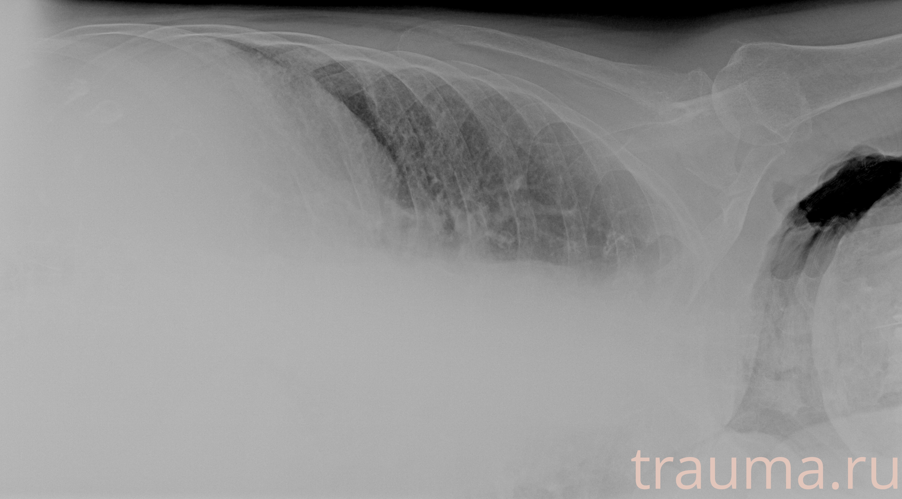 Рентген на дому: по вашему адресу приезжает врач-рентгенолог, травматолог-ортопед с мобильным рентгеновским аппаратом, проводит диагностику травмы или заболевания, делает необходимые рентгенограммы, дает рекомендации по дальнейшему лечению. Получить качественные снимки в домашних условиях возможно благодаря уникальной методике, разработанной МосРентген Центром для института  Склифосовского