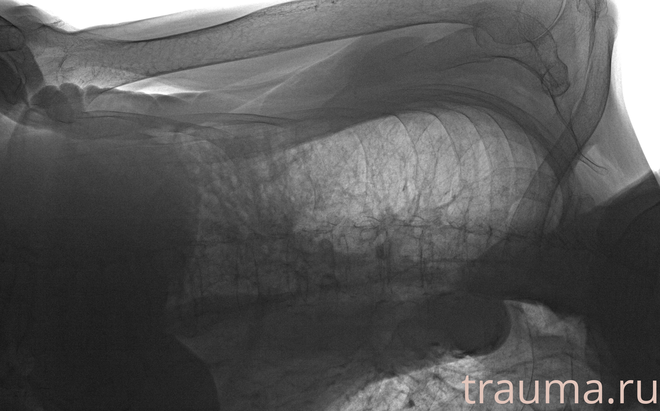 Рентген на дому: по вашему адресу приезжает врач-рентгенолог, травматолог-ортопед с мобильным рентгеновским аппаратом, проводит диагностику травмы или заболевания, делает необходимые рентгенограммы, дает рекомендации по дальнейшему лечению. Получить качественные снимки в домашних условиях возможно благодаря уникальной методике, разработанной МосРентген Центром для института  Склифосовского
