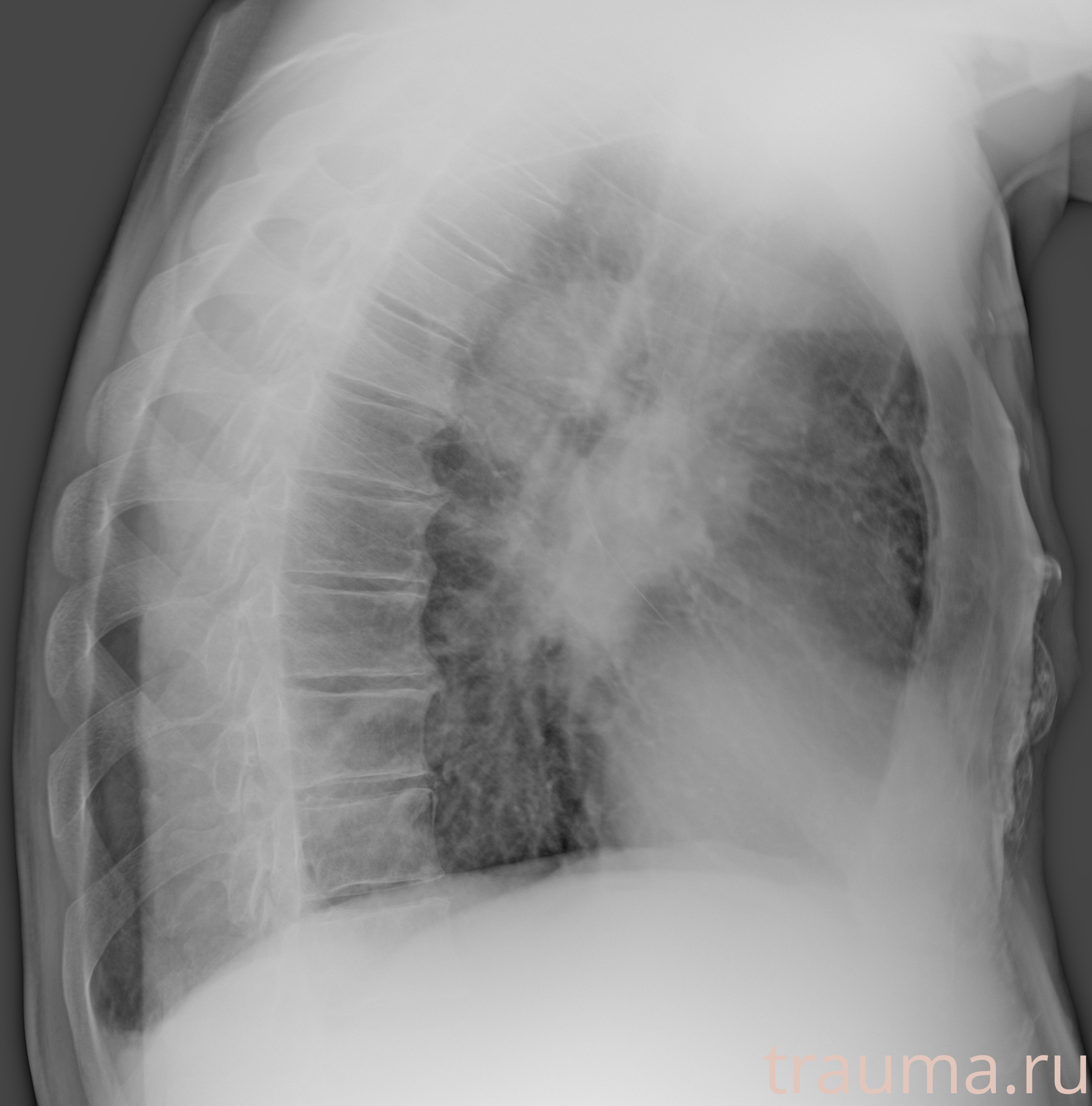 Рентген на дому: по вашему адресу приезжает врач-рентгенолог, травматолог-ортопед с мобильным рентгеновским аппаратом, проводит диагностику травмы или заболевания, делает необходимые рентгенограммы, дает рекомендации по дальнейшему лечению. Получить качественные снимки в домашних условиях возможно благодаря уникальной методике, разработанной МосРентген Центром для института  Склифосовского