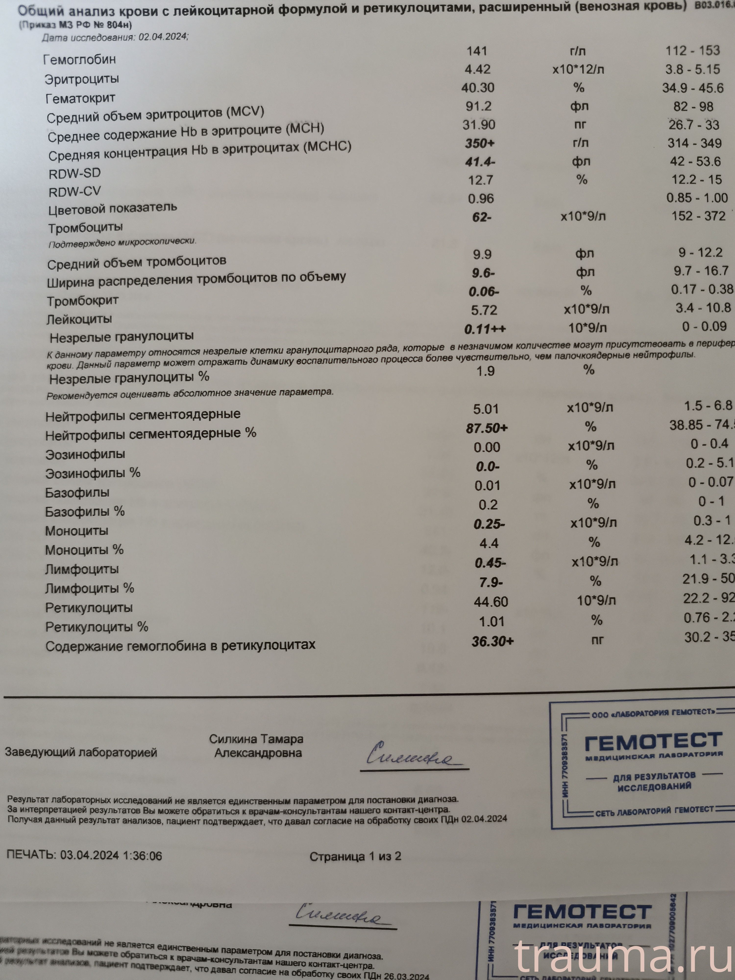Рентген на дому: по вашему адресу приезжает врач-рентгенолог, травматолог-ортопед с мобильным рентгеновским аппаратом, проводит диагностику травмы или заболевания, делает необходимые рентгенограммы, дает рекомендации по дальнейшему лечению. Получить качественные снимки в домашних условиях возможно благодаря уникальной методике, разработанной МосРентген Центром для института  Склифосовского