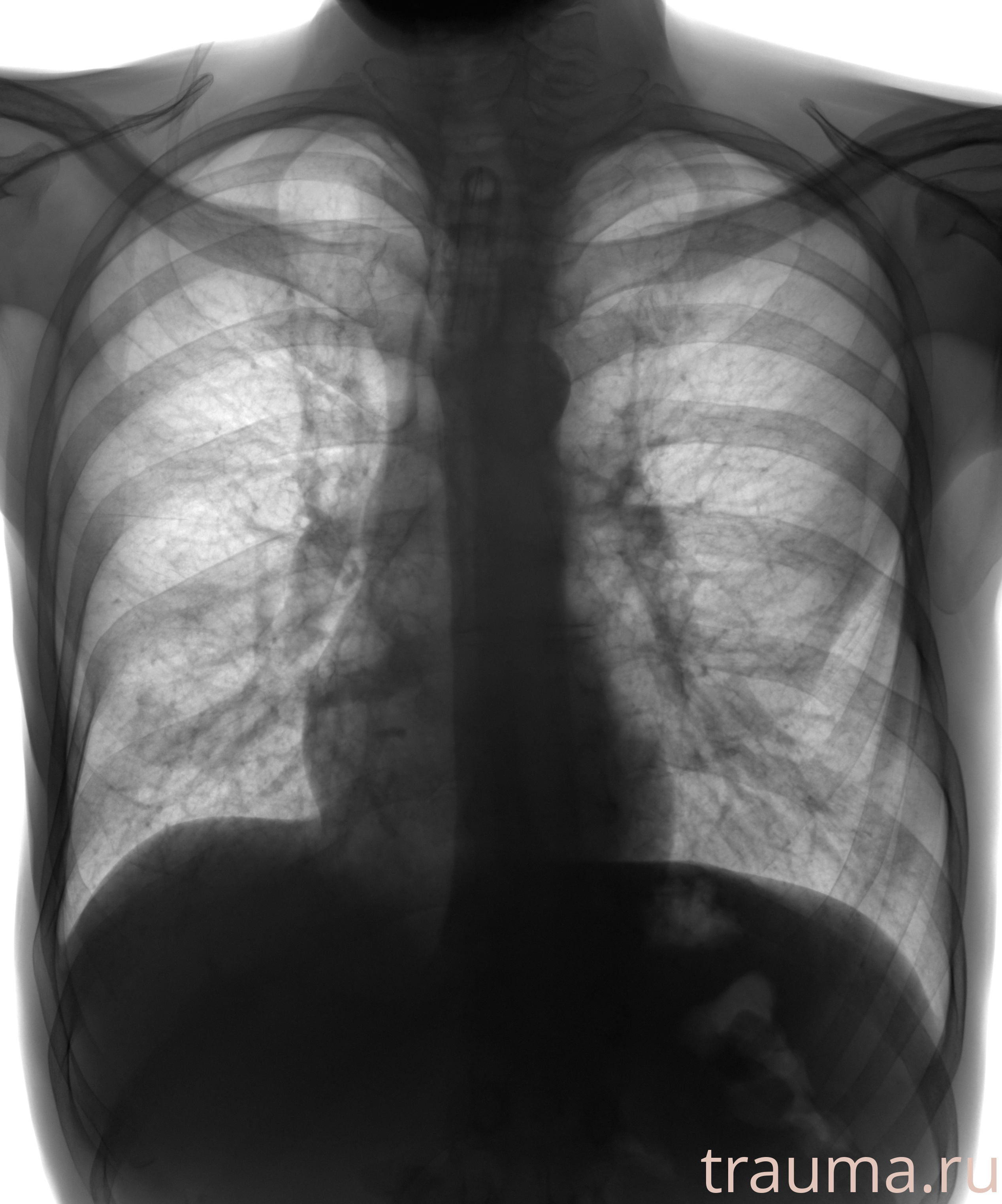 Рентген на дому: по вашему адресу приезжает врач-рентгенолог, травматолог-ортопед с мобильным рентгеновским аппаратом, проводит диагностику травмы или заболевания, делает необходимые рентгенограммы, дает рекомендации по дальнейшему лечению. Получить качественные снимки в домашних условиях возможно благодаря уникальной методике, разработанной МосРентген Центром для института  Склифосовского