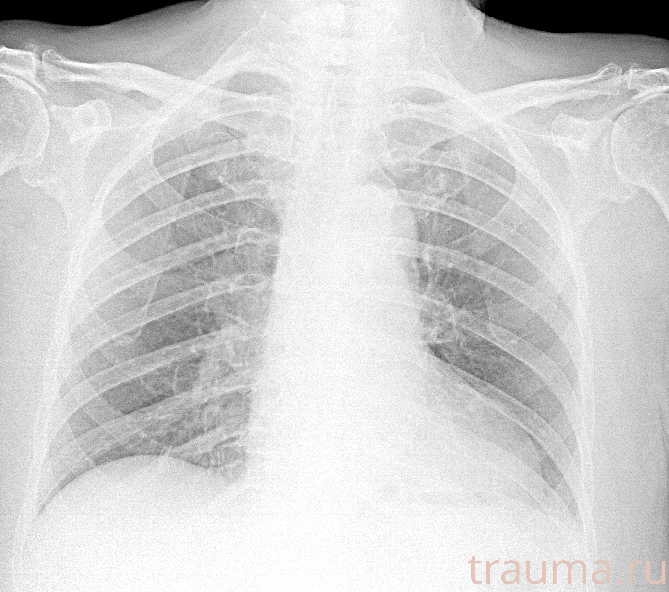 Рентген на дому: по вашему адресу приезжает врач-рентгенолог, травматолог-ортопед с мобильным рентгеновским аппаратом, проводит диагностику травмы или заболевания, делает необходимые рентгенограммы, дает рекомендации по дальнейшему лечению. Получить качественные снимки в домашних условиях возможно благодаря уникальной методике, разработанной МосРентген Центром для института  Склифосовского