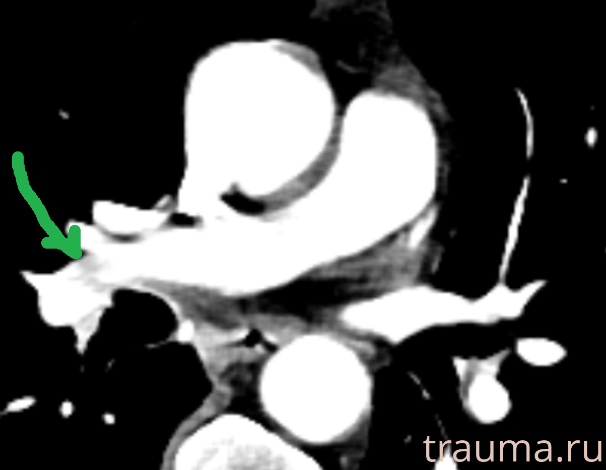 Рентген на дому: по вашему адресу приезжает врач-рентгенолог, травматолог-ортопед с мобильным рентгеновским аппаратом, проводит диагностику травмы или заболевания, делает необходимые рентгенограммы, дает рекомендации по дальнейшему лечению. Получить качественные снимки в домашних условиях возможно благодаря уникальной методике, разработанной МосРентген Центром для института  Склифосовского