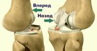 Ошибки, осложнения и их профилактика при оперативном лечении вывиха надколенника Ошибки, осложнения и их профилактика при оперативном лечении вывиха надколенника